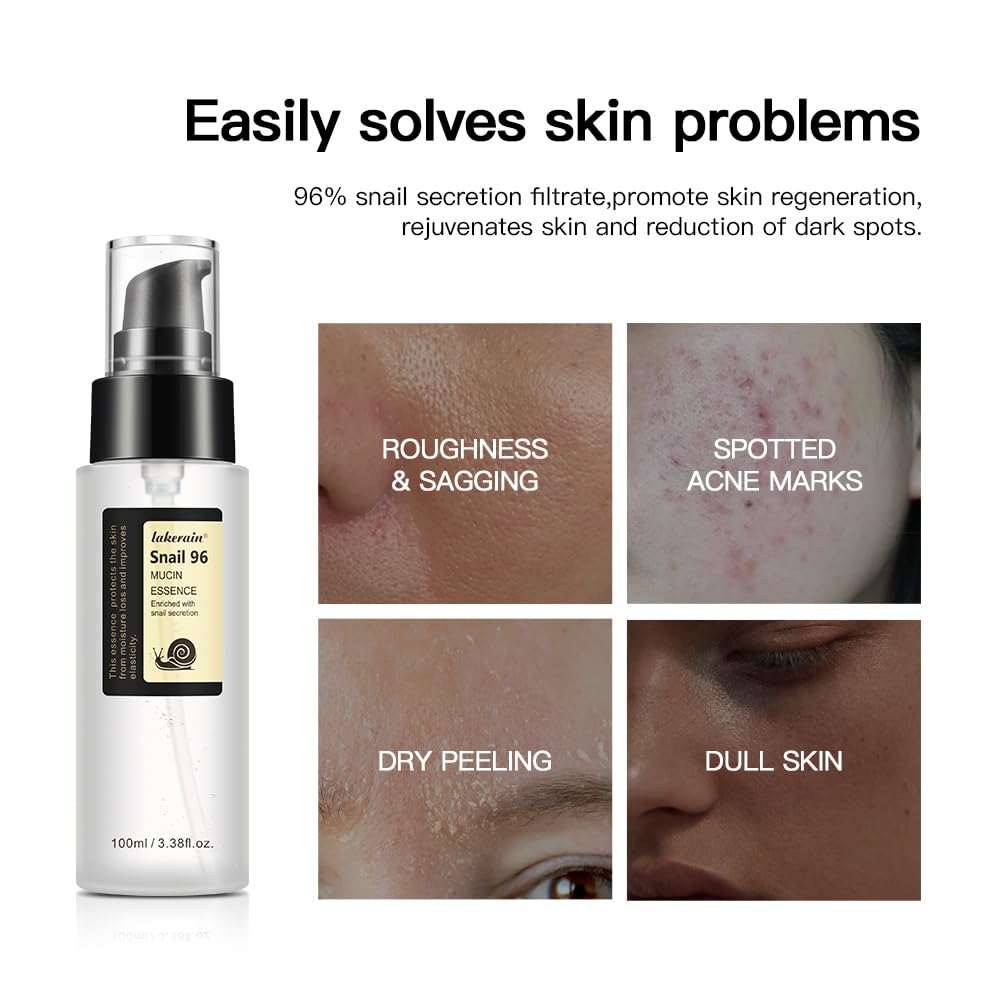 100ML Snail Mucin Serum for Face - Advanced Snail 96 Mucin Power Essence with Hyaluronic Acid | Dark Spot Repair, Hydration & Moisture Boost | Improve Skin Vitality & Elasticity | Perfect for Dry, Sensitive & Aging Skin Care Routine