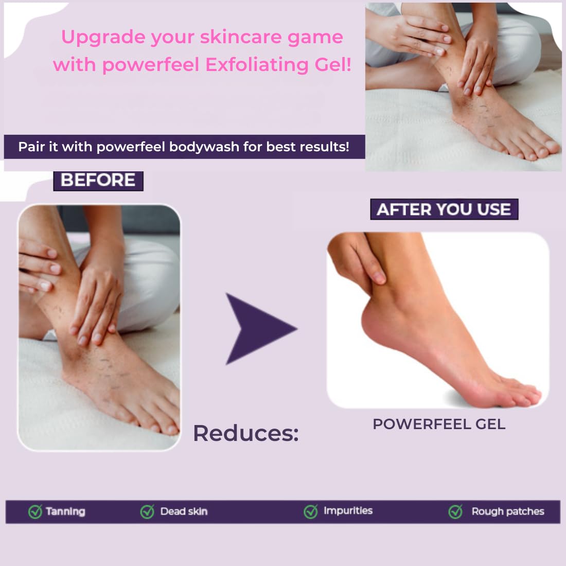 POWERFEEL Tanning & Dead Skin Removal Exfoliating Gel - 100ml | Visibly Removes Tan for Smooth & Bright Skin | Gentle Exfoliation for Face & Body | Perfect for Post-Sun Care & Daily Skincare Routine