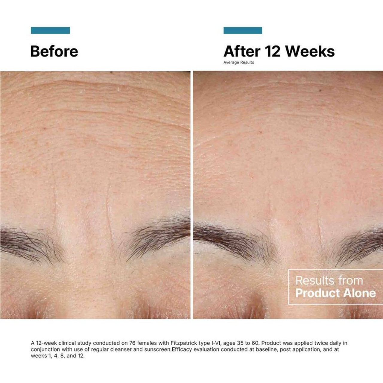 SkinCeuticals Advanced RGN 6 Anti-Aging Serum with Retinol - Brightening & Wrinkle Reduction Treatment for Face - Perfect for Nighttime Skincare Routine & Dermatologist-Recommended Regimen