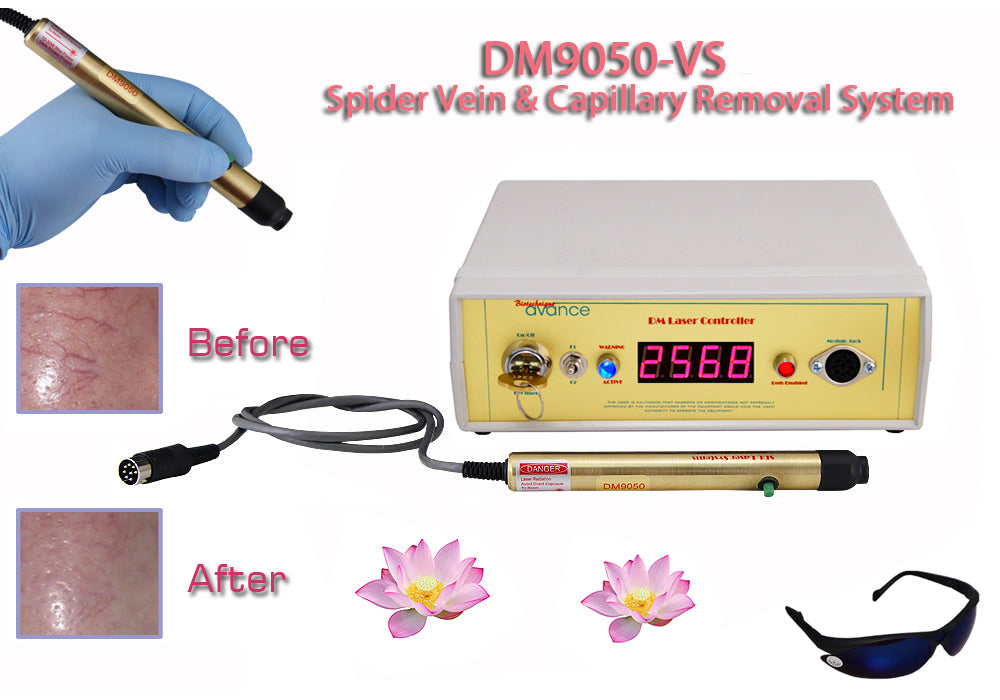 Professional Spider Vein & Thread Vein Treatment Machine DM9050 VSC - Advanced Vascular Therapy for Clinics & Dermatology Centers