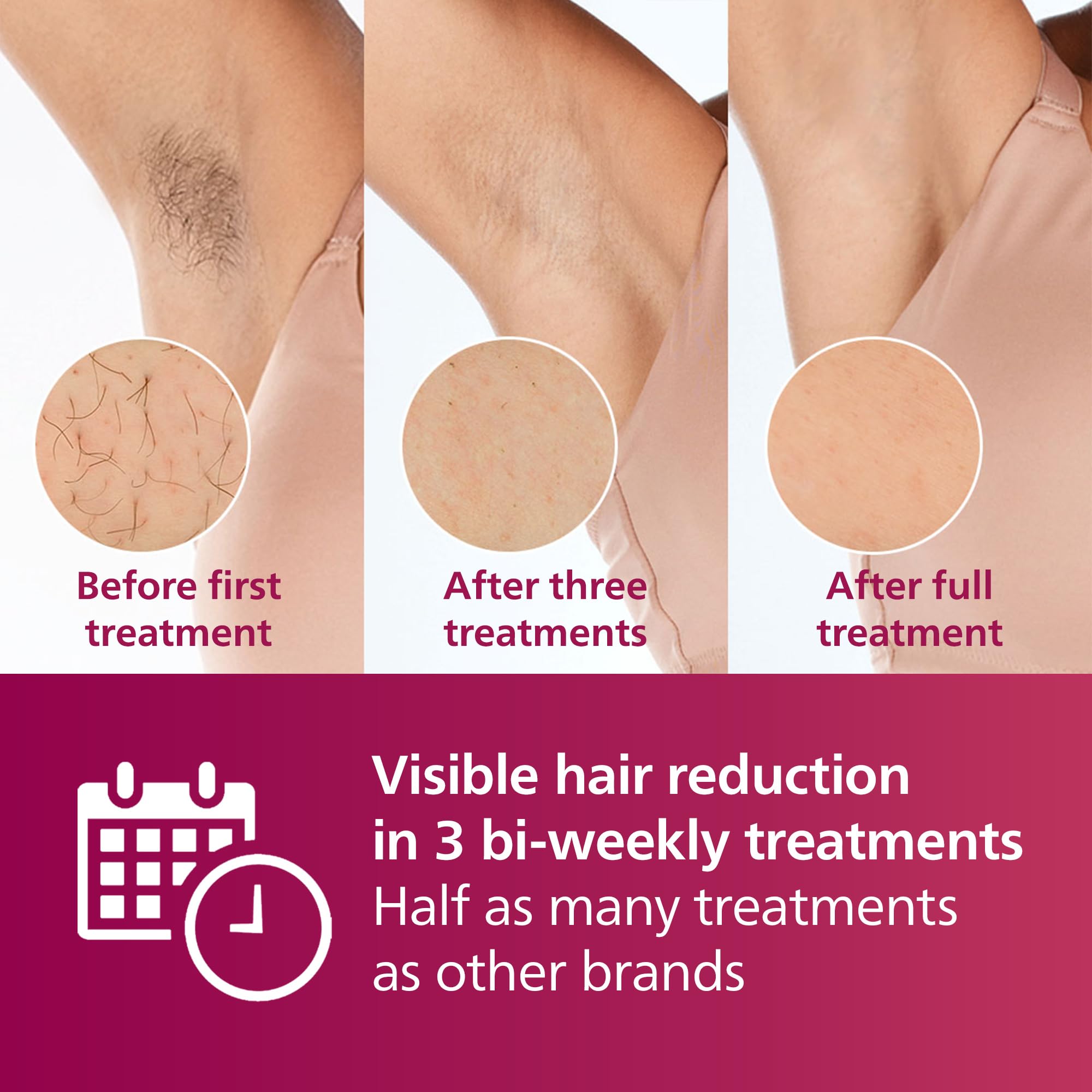 Philips Lumea IPL Hair Removal Device BRI921/00 - Permanent Hair Removal System for Women & Men with Satin Compact Trimmer, 2 Attachments for Body & Face, Corded Use - At-Home Hair Removal for Smooth Skin on Legs, Arms, Bikini Line & Face