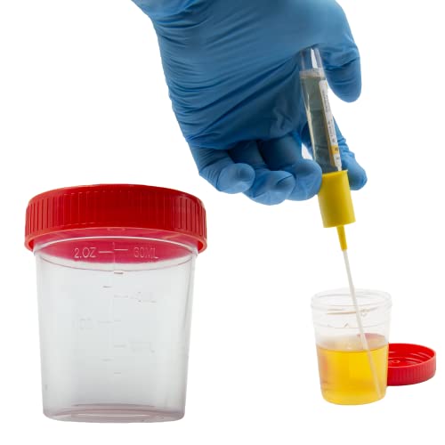 Sterile 60ml (2oz) Urine Specimen Cups with Leak-Proof Screw-On Lids - Kashi Scientific Specimen Collection Containers for Medical, Laboratory & Home Use - Ideal for Urine, Stool & Biological Samples Testing
