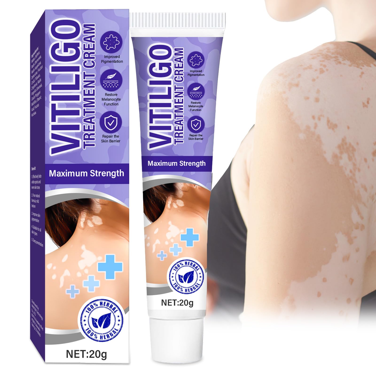 Natural Vitiligo Treatment Cream for Skin Pigmentation - Safe & Effective Solution to Restore Skin Tone | Perfect for Daily Use on Face & Body