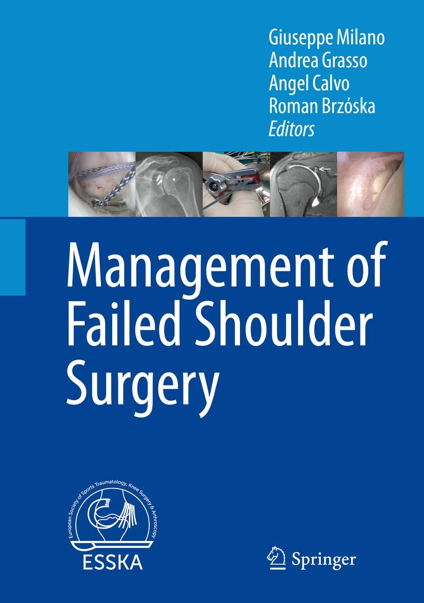 Failed Shoulder Surgery Management Guide - Treatment Options & Recovery Tips for Post-Surgical Shoulder Pain Relief | Ideal for Athletes & Active Adults