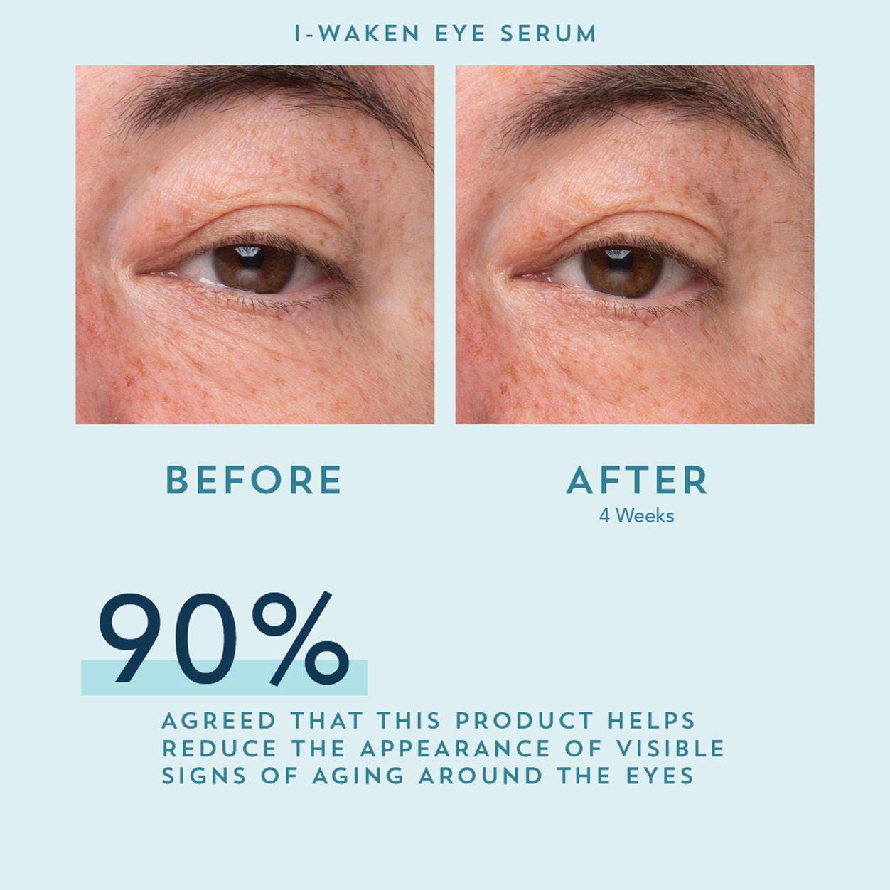 I Waken Eye Serum - Anti-Aging & Dark Circle Treatment for Brighter Eyes | Day & Night Use for Puffy Eyes & Fine Lines