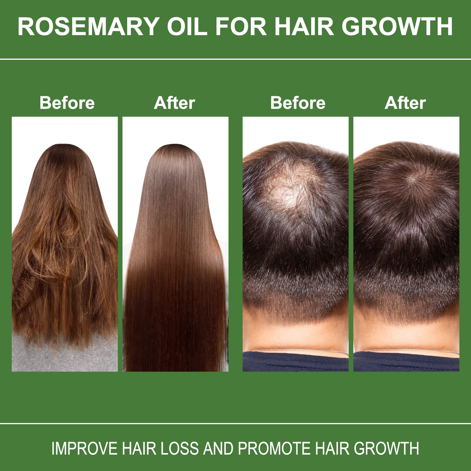 Pure Organic Rosemary Oil for Hair Growth 120ml - Natural Hair Loss Treatment & Scalp Care for Men & Women - Promotes Thicker, Healthier Hair - Ideal for Daily Hair Care & Massage