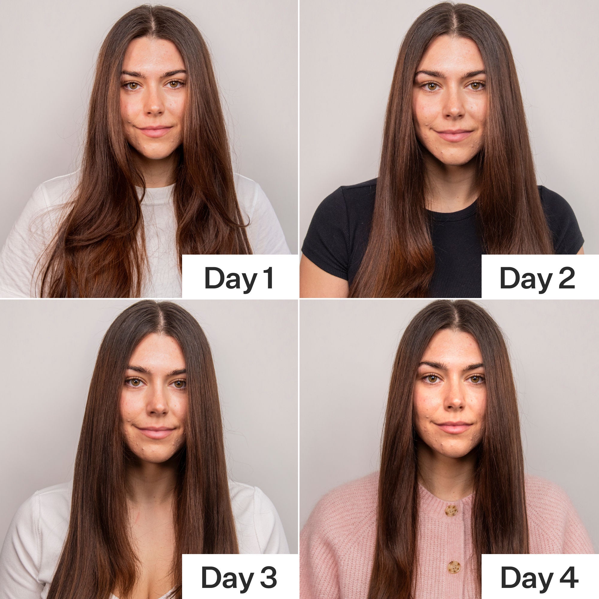 4% Niacinamide Scalp Serum for Oily Hair - Reduce Excess Oil & Soothe Irritation - Perfect for Daily Scalp Care & Hair Growth