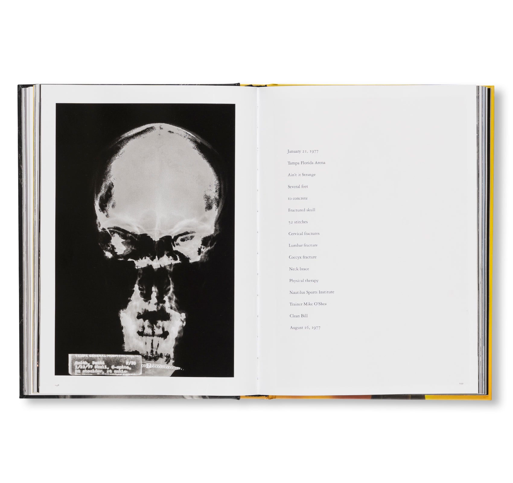 Patti Smith: Before Easter After - Signed Edition by Patti Smith & Lynn Goldsmith | Rare Collectible Book for Music Lovers & Photography Enthusiasts