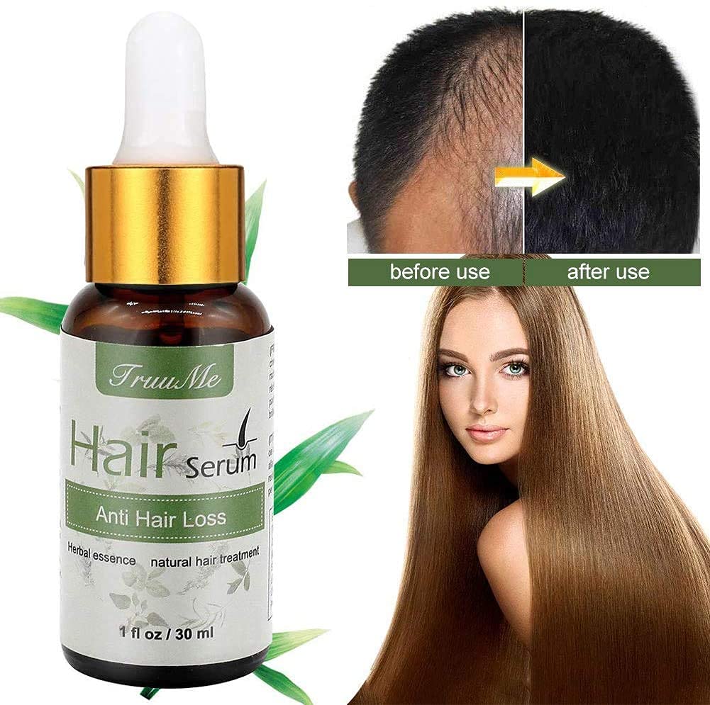 Natural Herbal Hair Regrowth Serum for Thinning Hair - Anti Hair Loss Treatment for Fast Growth & Thickening - Best for Men & Women - Use Daily for Fuller, Healthier Hair (Home & Salon Use)