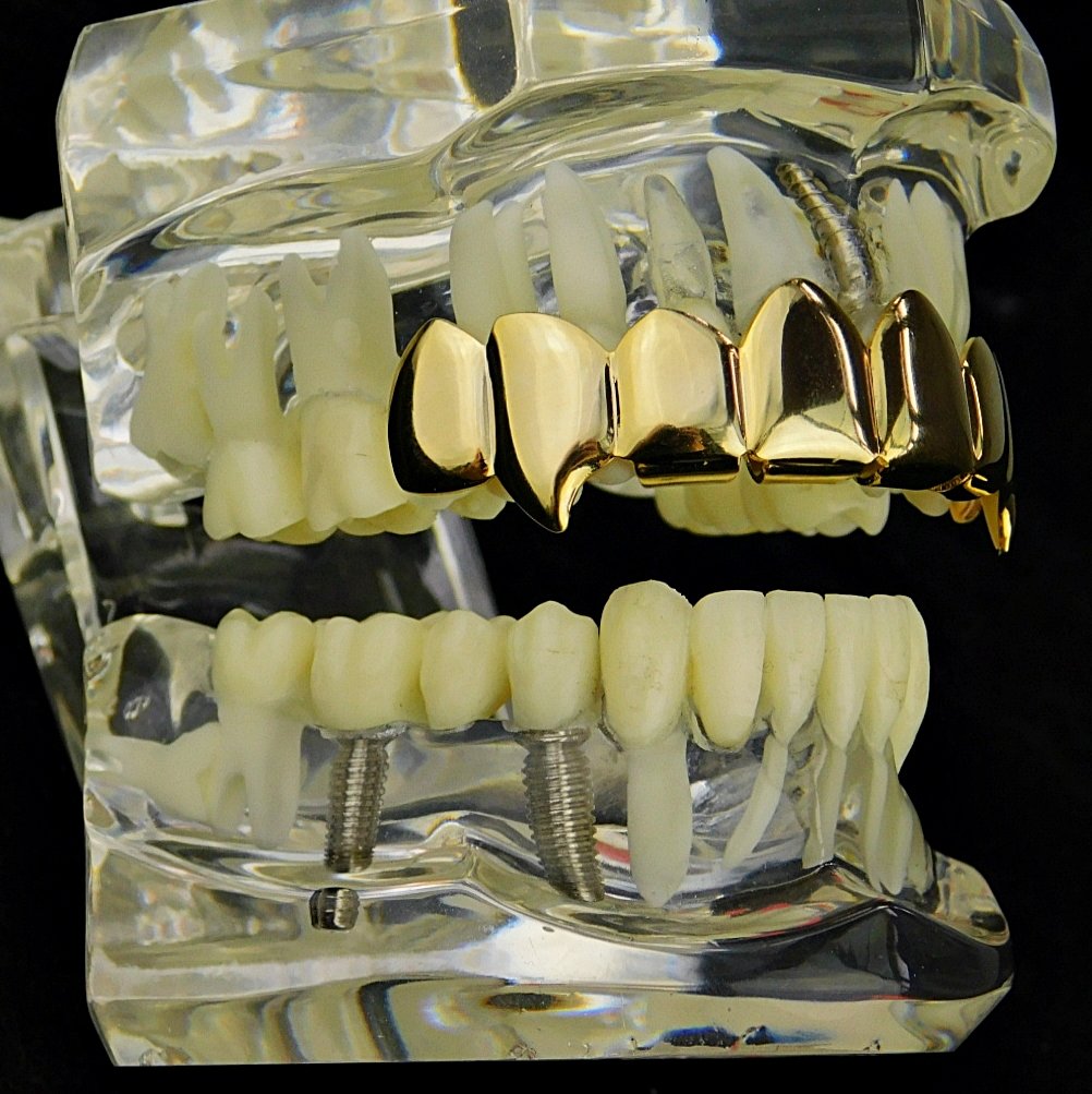 14K Gold Plated Fang Grillz - 8 Top Teeth Vampire Grills for Hip Hop & Halloween Costume | Perfect for Rappers, Performers & Cosplay Enthusiasts
