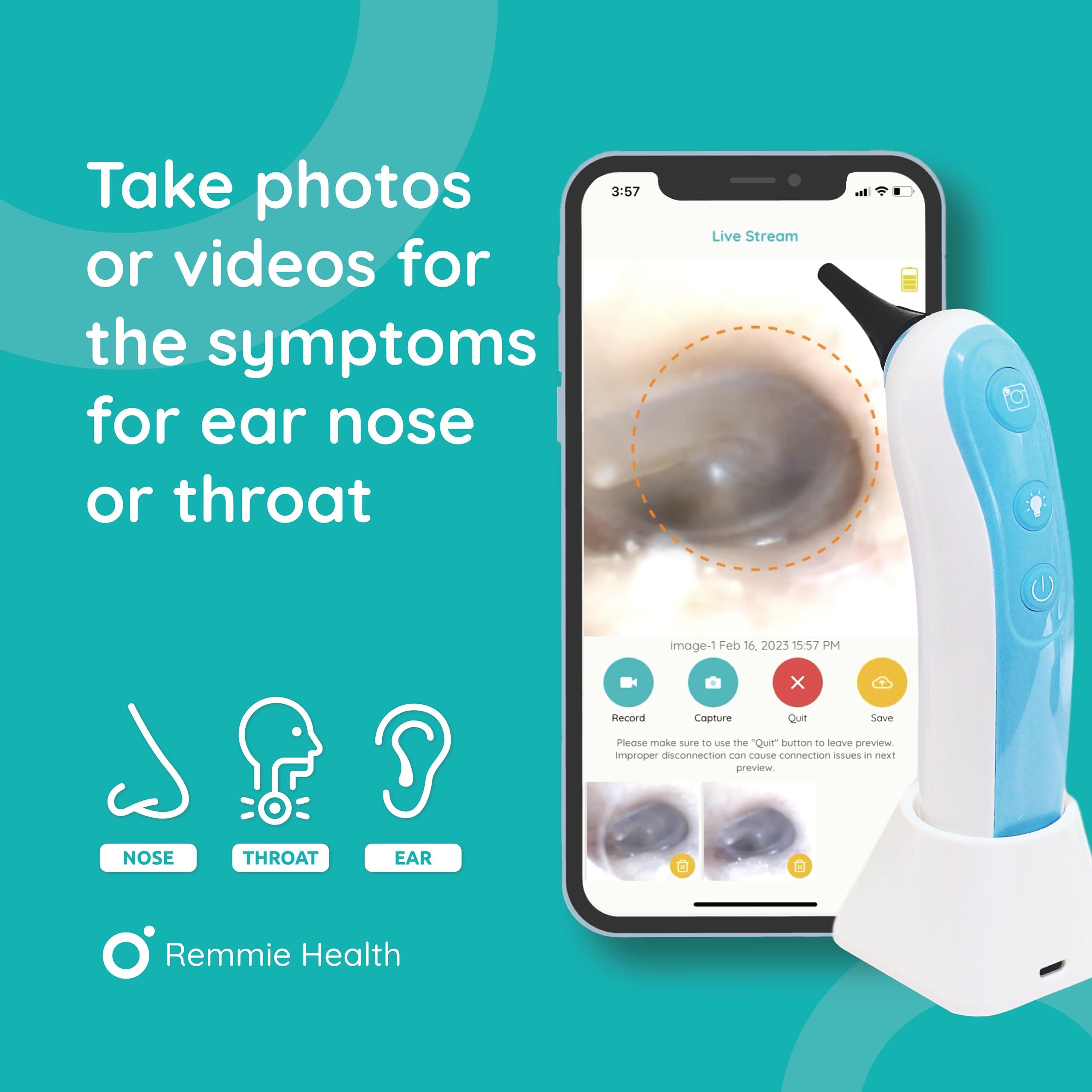 Wireless Otoscope Ear Camera - FDA Approved Remmie Dolphin Digital Ear Scope for iPhone & Android | ENT, Throat, Nose & Skin Examination | Pediatrician Recommended for Kids & Adults | Home Health Check & Telemedicine Use