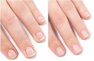 Intensive Hydrating & Brightening Nail Trio Treatment Set - Hydrate, Strengthen & Repair Dry Brittle Nails | Professional Nail Care Kit for Soft Cuticles & Healthy Nails | Perfect for Home Manicures & Salon Use