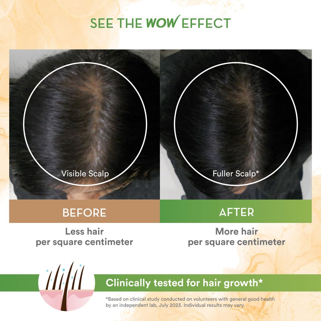 WOW Skin Science Rosemary & Biotin Hair Growth Shampoo - Reduces Hair Fall, Stimulates New Growth, Prevents Breakage & Split Ends, Adds Shine - 8.8oz - For Thinning Hair & Scalp Care - Perfect for Daily Use at Home or Salon