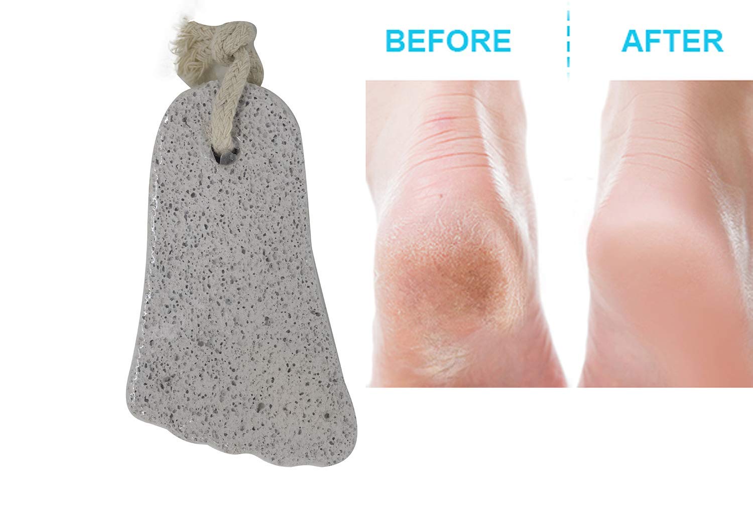Kabello Pumice Stone for Feet - Natural Dead Skin Remover & Foot Scrubber for Men & Women (Pack of 1) - Perfect for Pedicures, Callus Removal & Soft Feet Care at Home