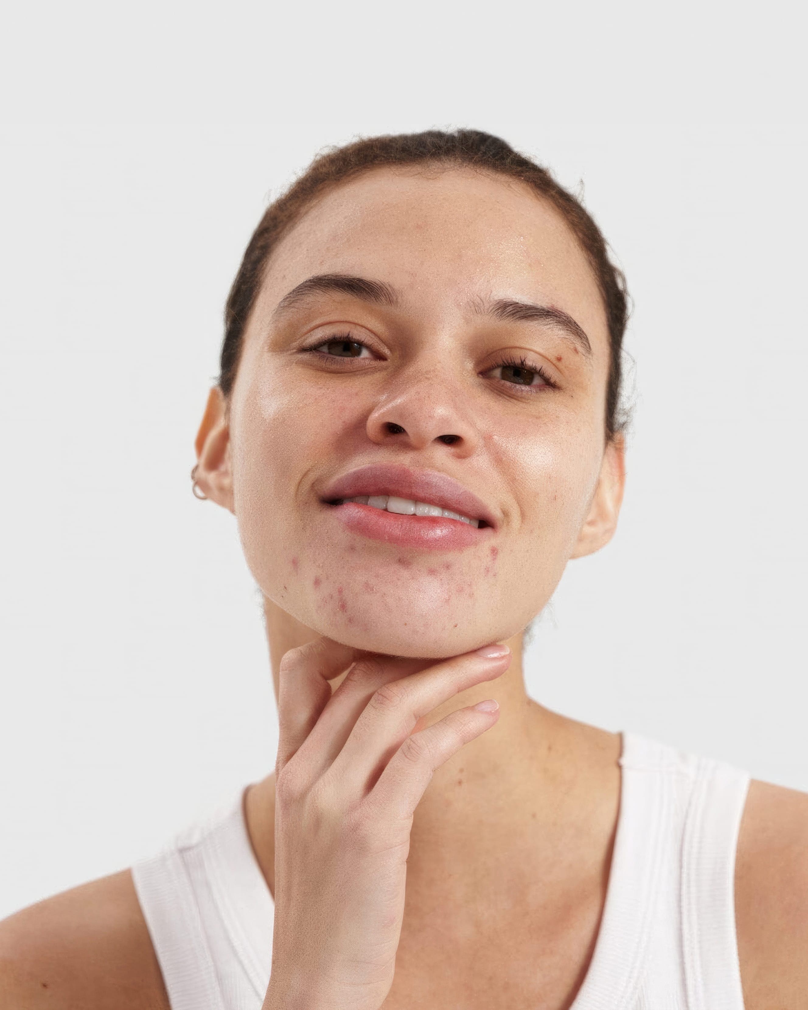 PHAZE Rebalance Clarifying Cleanser for Acne-Prone & Oily Skin - Gentle Face Wash with Salicylic Acid & Tea Tree Oil - Deep Cleansing for Clear, Balanced Skin - Perfect for Daily Skincare Routine & Post-Workout Use