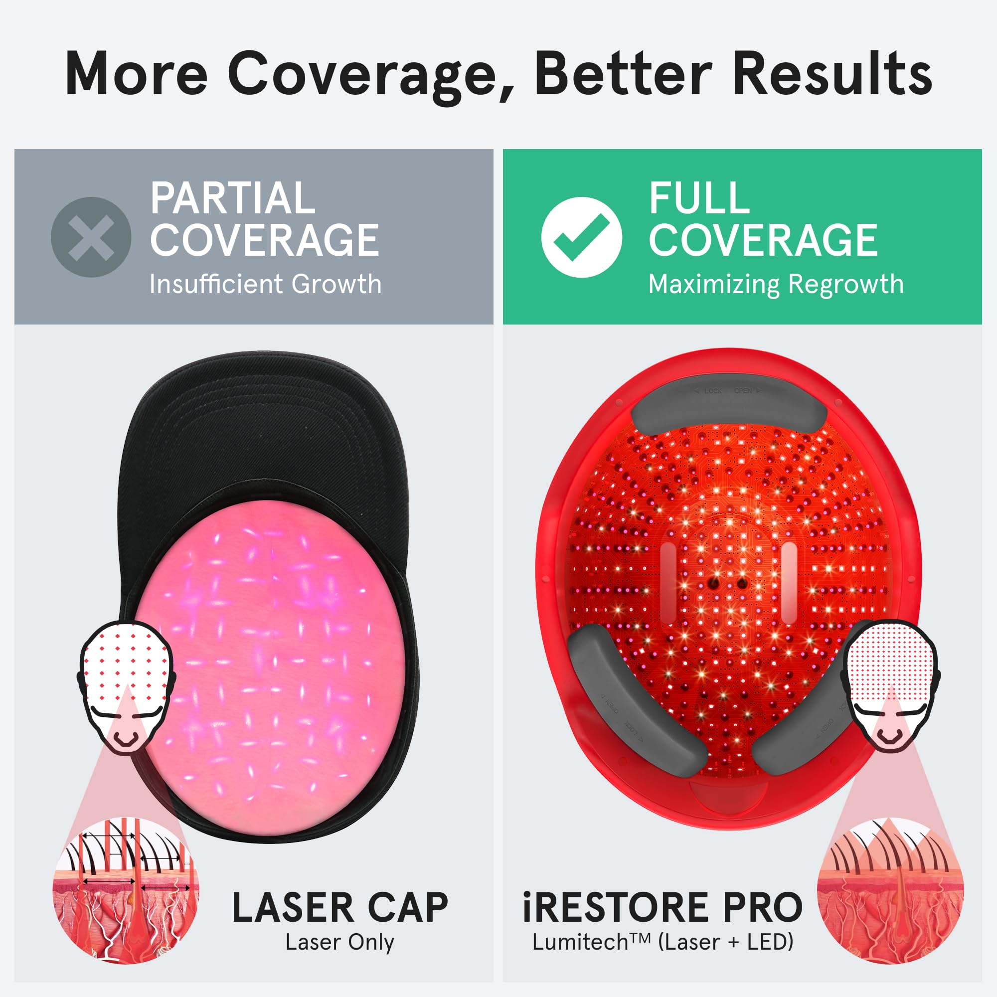 iRestore Professional Laser Red Light Therapy Hair Growth System - FDA Cleared Hair Loss Treatment for Men & Women - 282 Lasers & LEDs Laser Cap for Hair Regrowth - Effective for Alopecia & Thinning Hair - Perfect for Home Use & Salon Treatments