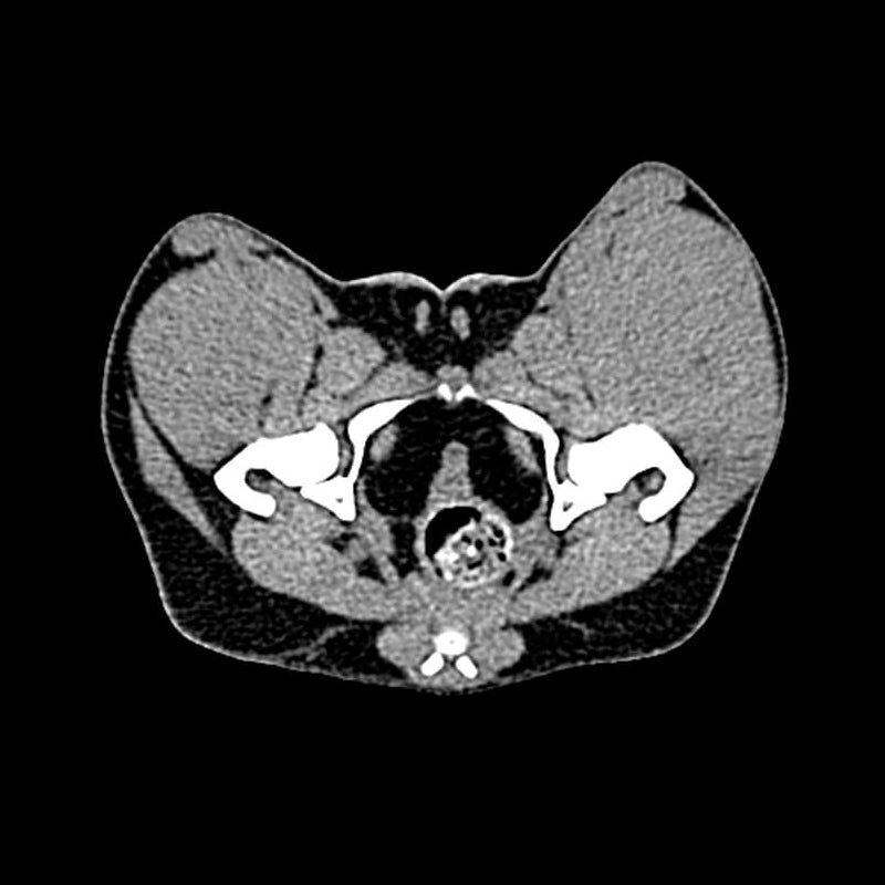Dog Pelvis Phantom for CT Scan & X-Ray Training - Veterinary Radiology Practice, Canine Anatomy Study, Medical Imaging Education