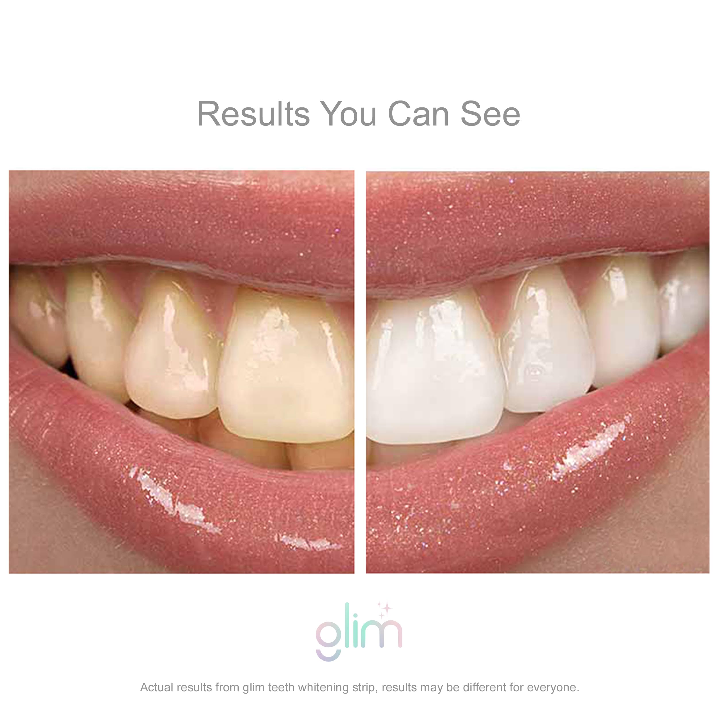 Professional Teeth Whitening Kit - 42 Strips (21 Treatments) | Hydrogen-Free, Non-Toxic, Dentist Recommended | Sensitivity-Free, Vegan & Cruelty-Free | Mint Flavor | For Brighter Smile at Home, Weddings & Special Events