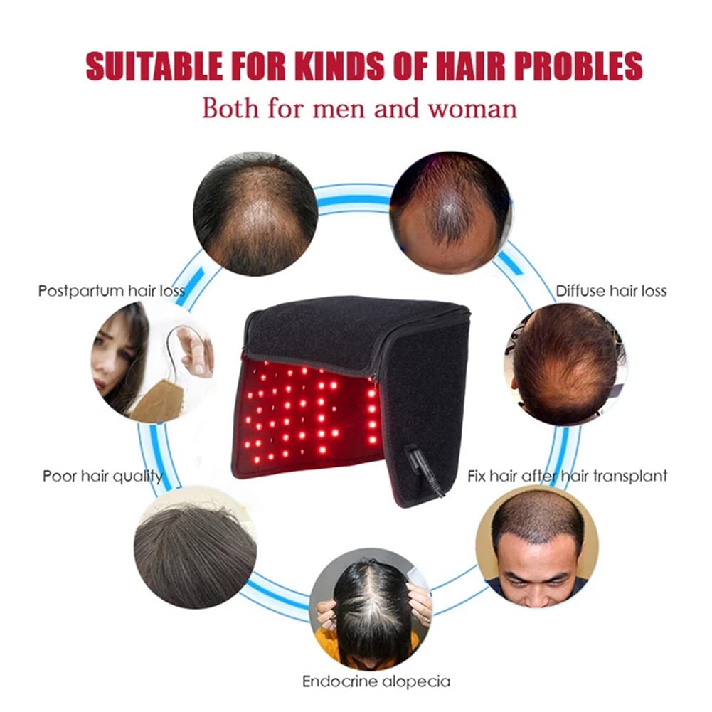 RR-YRL Hair Growth Device - 215 LED Red Light Therapy Helmet for Hair Regrowth & Follicle Healing | Anti-Hair Loss Treatment Cap for Men & Women | At-Home Hair Care Solution for Thinning Hair & Scalp Health