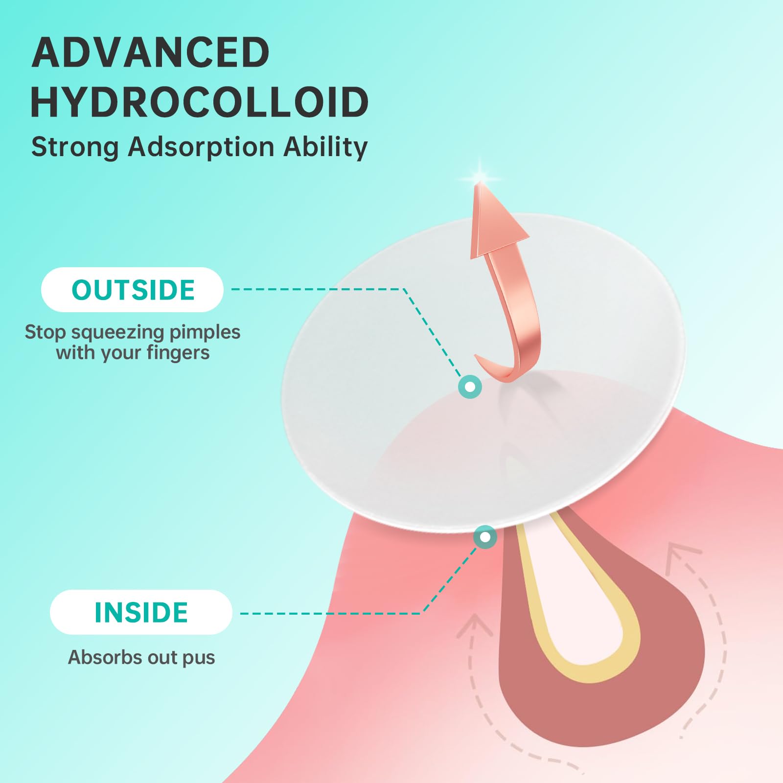 Hydrocolloid Acne Patches for Face - 210 Count Pimple Patches in 4 Sizes, Absorbs Fluid & Treats Zits, Blemishes & Breakouts | Perfect for Overnight Spot Treatment & Daily Acne Care