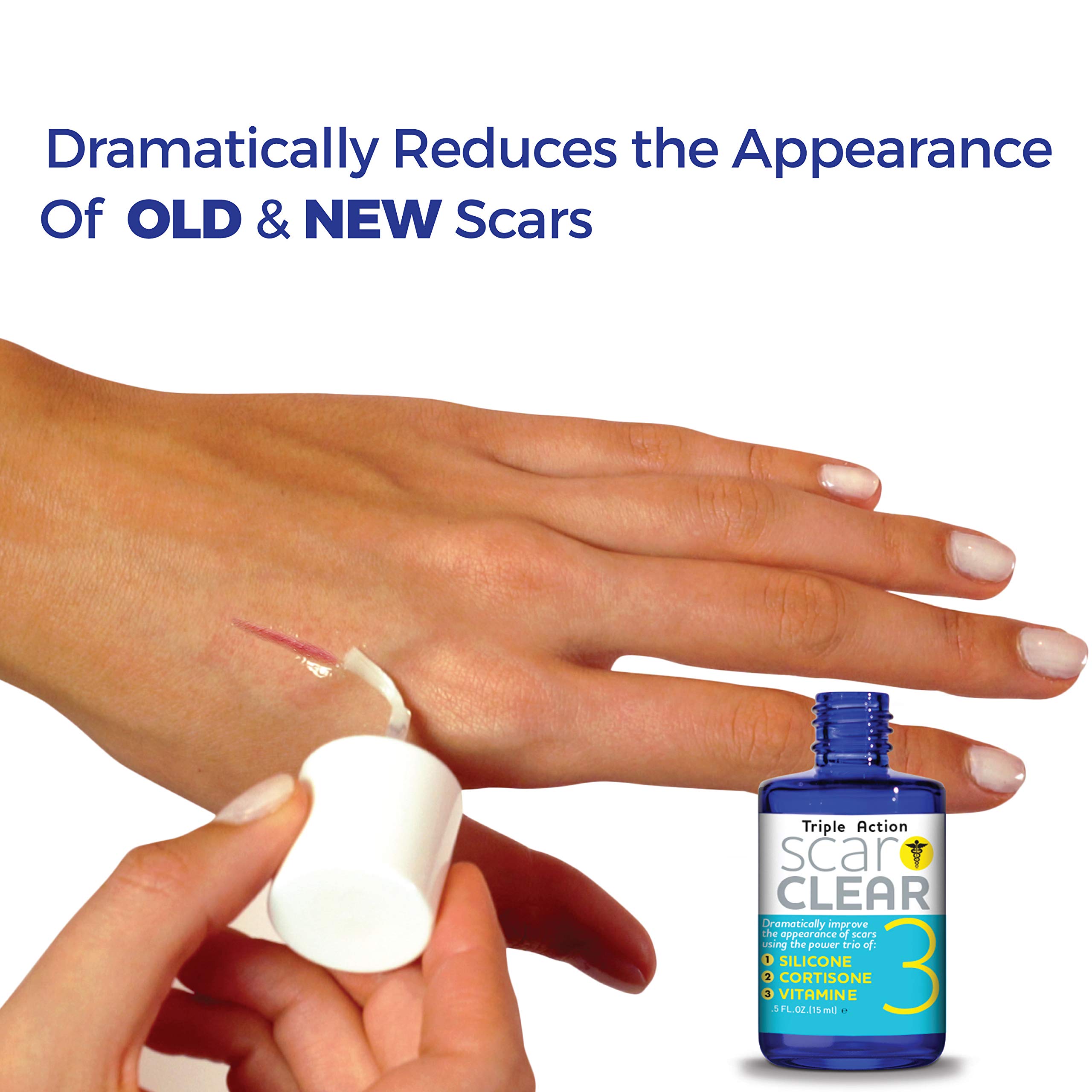 Triple Action Scar Treatment Cream - 0.5oz for Face & Body | Reduces Appearance of Scars, Stretch Marks & Acne Marks | Post-Surgery & Injury Recovery