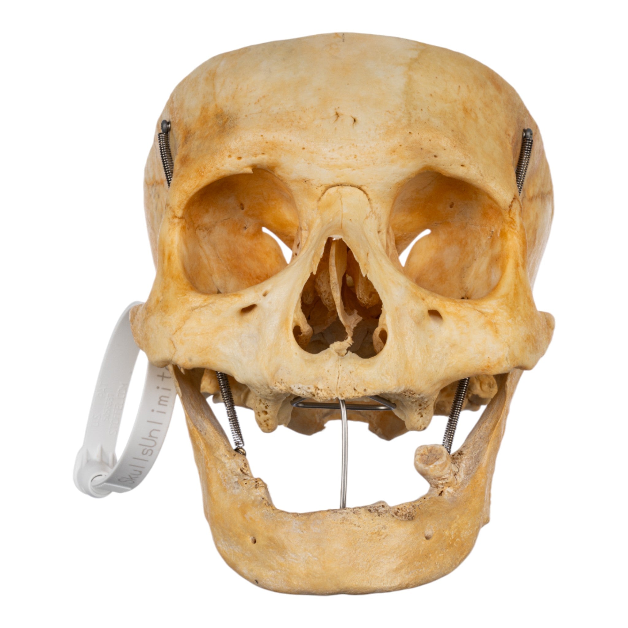 Authentic Real Human Skull Specimen - Partial Skull Bone for Medical Study, Anatomy Education & Halloween Decor | Perfect for Doctors, Students & Collectors
