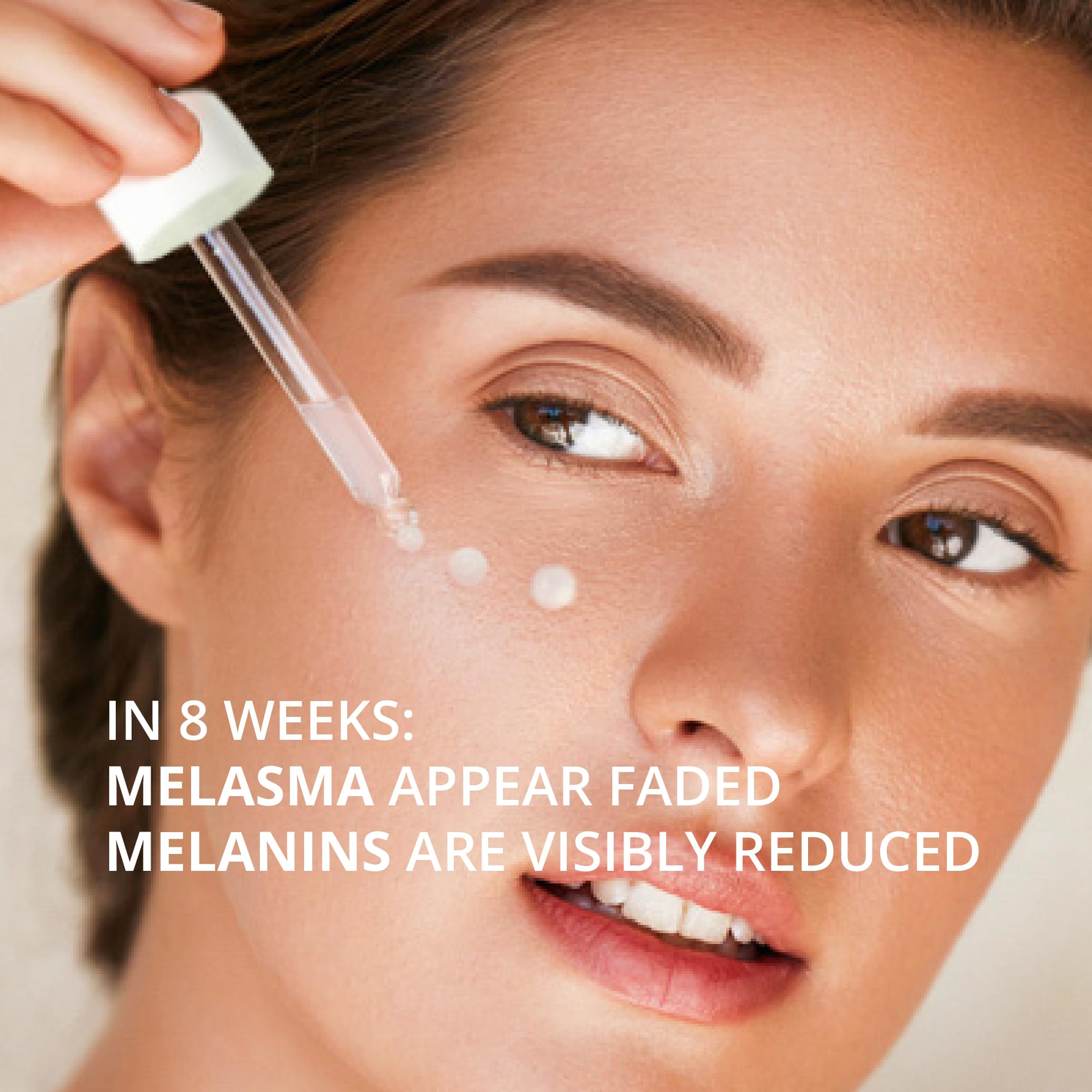 Abera Melasma Serum Plus - Advanced Dark Spot Corrector for Face | Sun Spot, Age Spot & Brown Spot Treatment for Men & Women (1 FL OZ) | Brightens Skin Tone & Reduces Hyperpigmentation | Ideal for Daily Skincare Routine & Post-Sun Care
