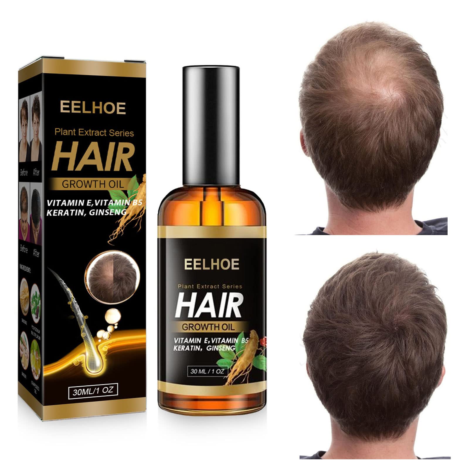 VISHUFASHION Hair Growth Serum for Men & Women - Natural Hair Oil to Stimulate Growth, Repair Follicles & Prevent Hair Loss | Hair Regrowth Treatment for Thinning Hair - Perfect for Daily Scalp Care & Hair Restoration
