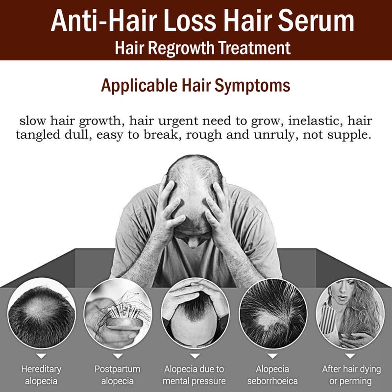 EIBHC Ginger Germinal Oil for Hair Growth - Natural Ginger Essential Oil Serum to Stop Hair Loss & Thinning - Hair Regrowth Treatment for Women & Men (30ml) - Promotes Healthy Scalp & Stronger Hair for Daily Hair Care Routine