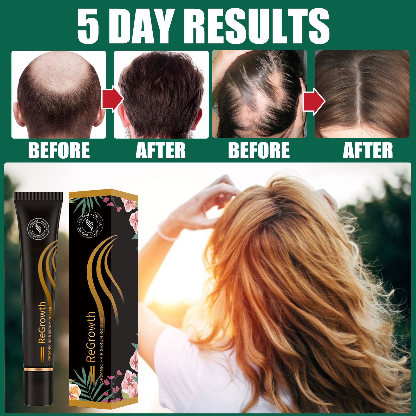 Organic Hair Growth Serum with Roller - Anti-Hair Loss Treatment for All Hair Types, Scalp Nourishing & Strengthening - Perfect for Thinning Hair & Daily Hair Care Routine