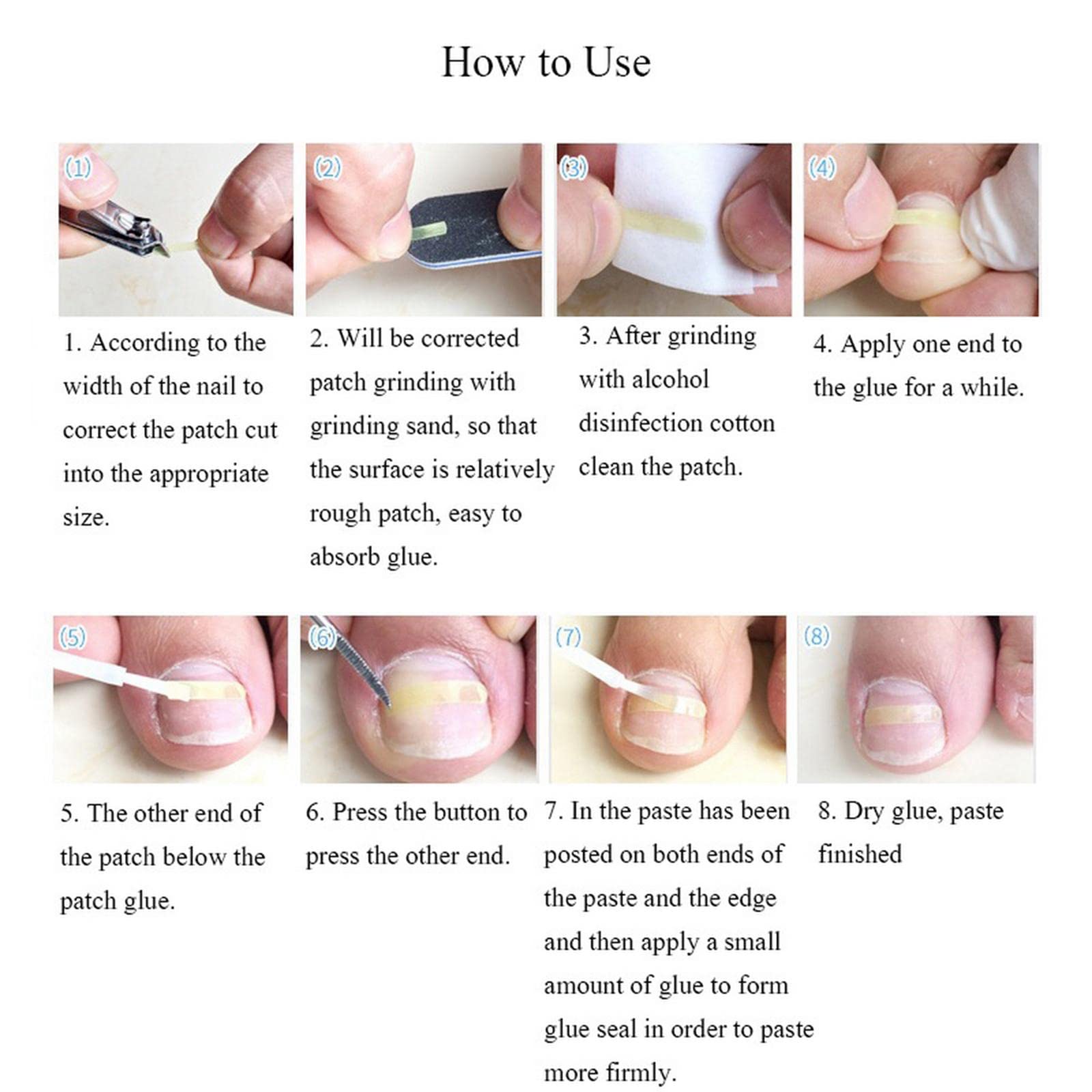 LOSA Ingrown Toenail Treatment - Professional Ingrown Toenail Correction Tool for Pain Relief & Pedicure Care | Perfect for Home Use, Salon Treatments & Foot Care Routines