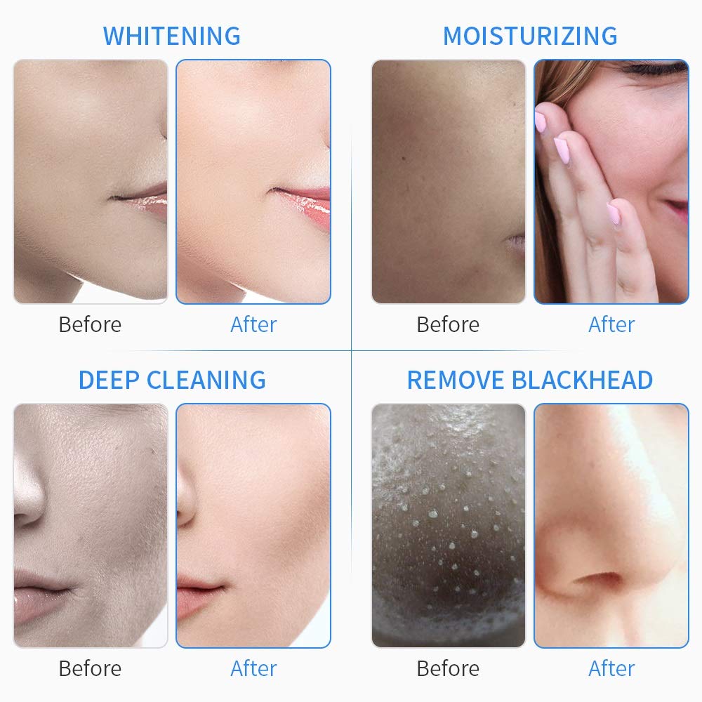 Professional 6-in-1 Diamond Microdermabrasion Machine for Skin Cleaning, Hydro Dermabrasion & Hydra Facial Massage | Pore Cleaner & Rejuvenation | Perfect for Spa, Salon & At-Home Skincare Treatments