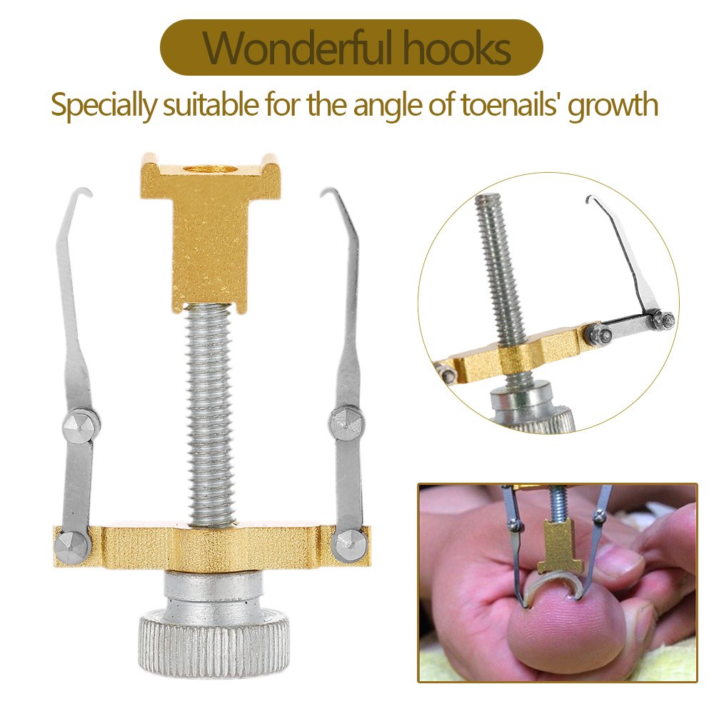 Ubersweet® Ingrown Toenail Correction Kit - Professional Nail Nipper, Cuticle Remover & Nail File for Toenail Treatment - Pedicure Tools for Pain Relief & Nail Care - Perfect for Home Use & Salon Professionals