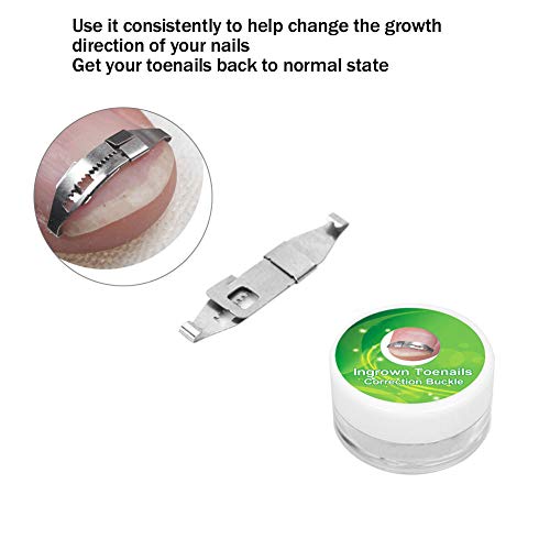 Yosoo Health Gear Stainless Steel Ingrown Toenail Corrector - Paronychia Treatment Tool & Nail Care Patch for Pain Relief | Perfect for Home Pedicure, Toenail Correction & Foot Care Routine