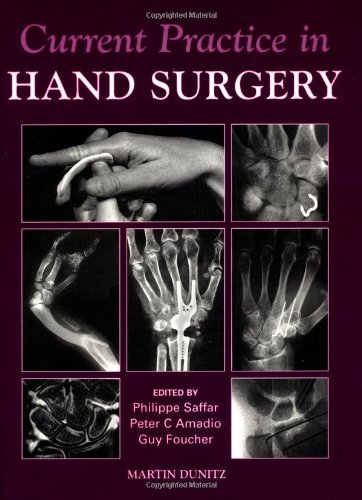 Current Practice in Hand Surgery - Expert Techniques & Procedures for Hand Surgeons | Ideal for Clinical Practice & Surgical Training