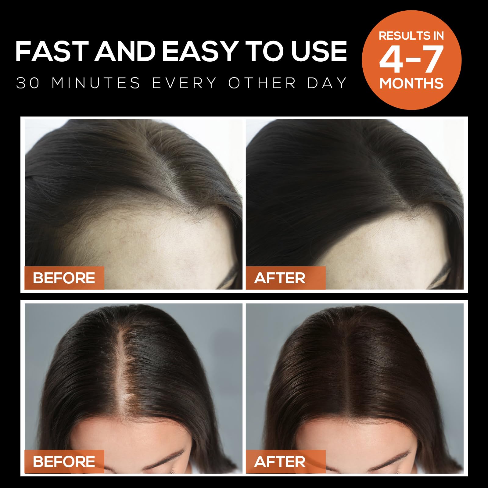 Laser Hair Growth Cap for Men & Women - FDA Cleared Red Light Therapy Cap for Hair Regrowth & Thinning Hair Treatment - Unisex Hair Loss Prevention Device for Home Use (Perfect for Daily Scalp Care & Hair Restoration)