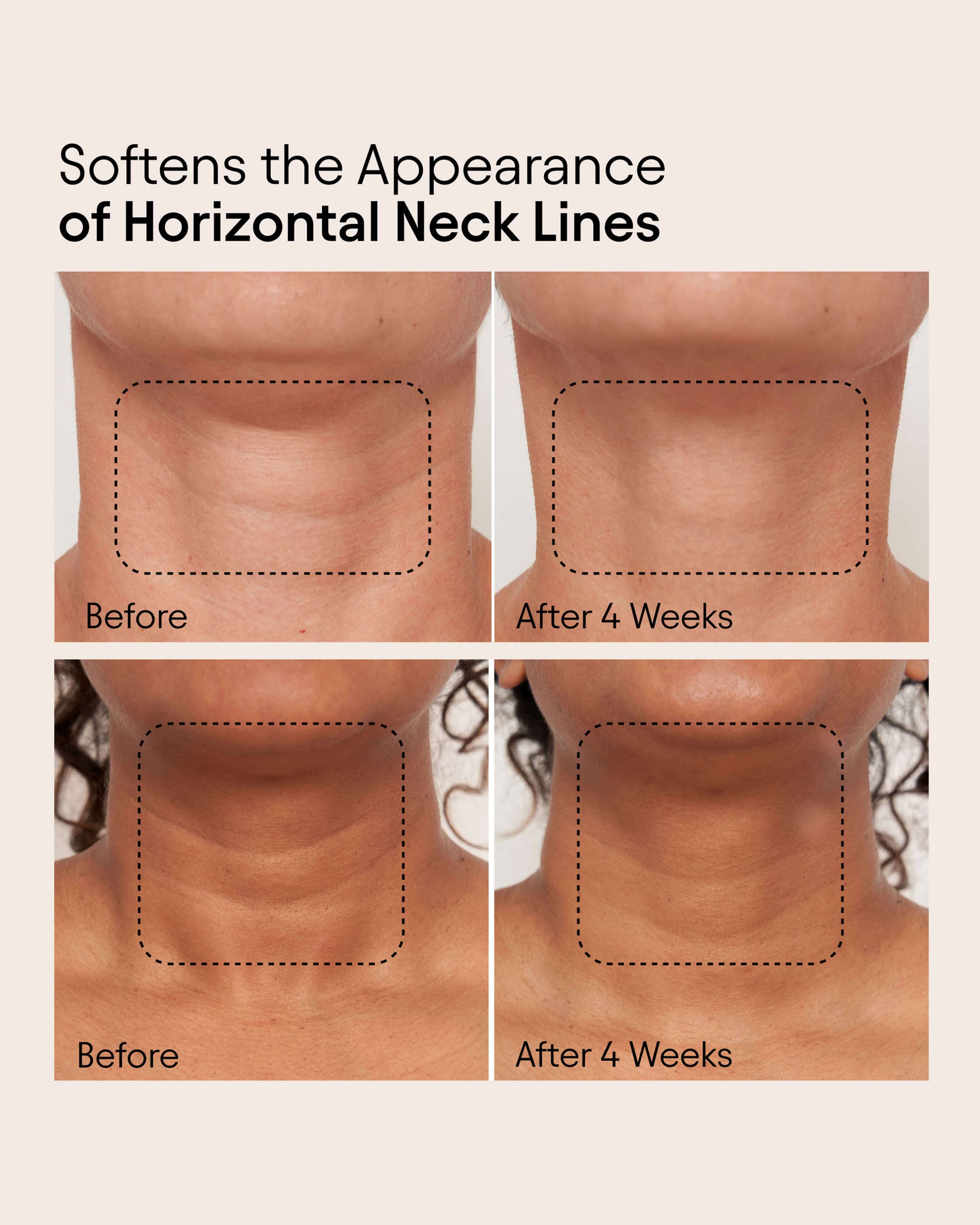 Super Sculpt Serum for Face & Neck - Anti-Aging Firming Treatment for Wrinkles & Sagging Skin | Perfect for Daily Skincare Routine & Nighttime Regimen
