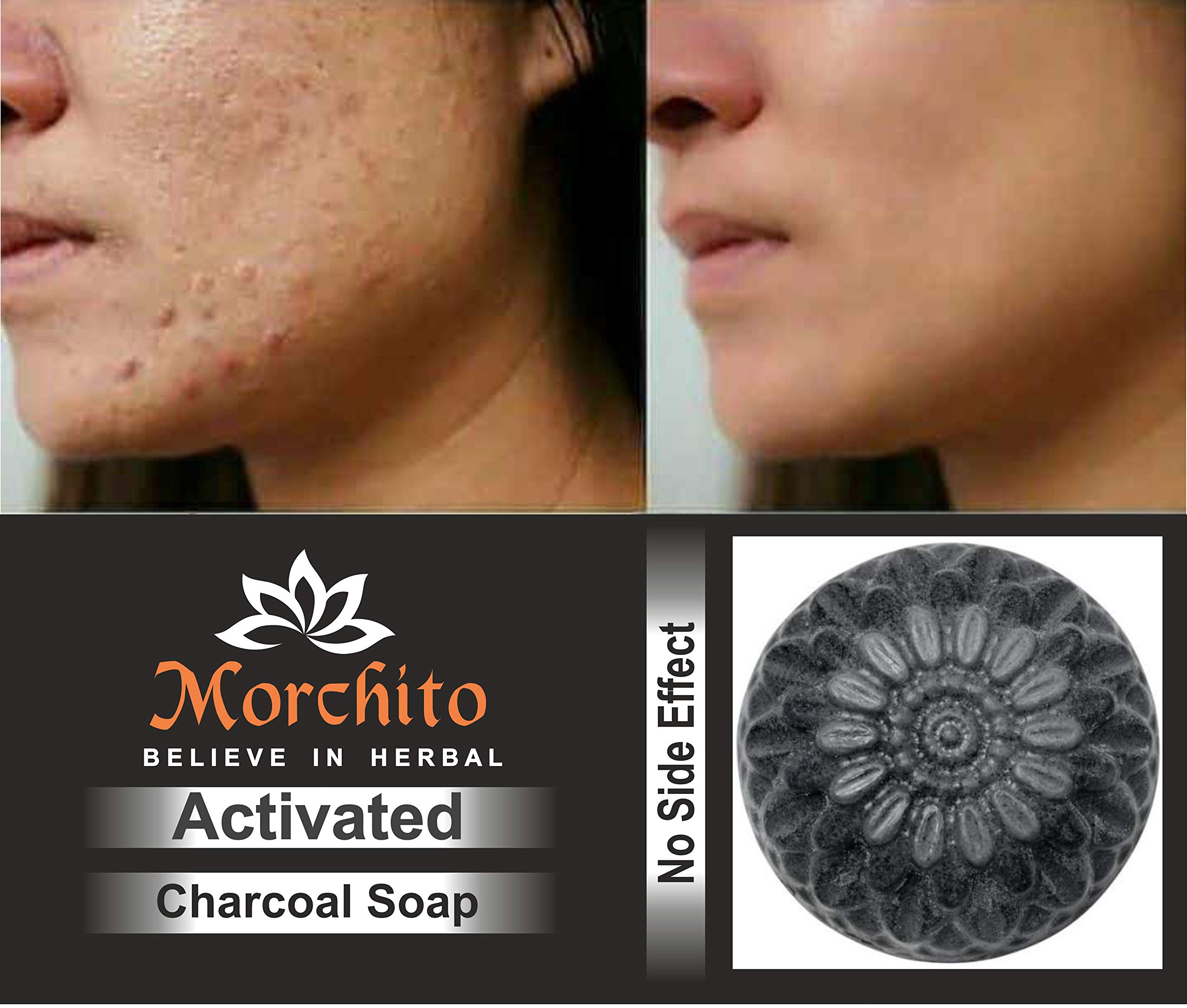 Morchito Charcoal Goat Milk Soap for Women - Skin Whitening, Acne & Blackhead Treatment, Natural Cleansing Bar (Pack of 4, 100g Total) | Gentle Face & Body Wash for Clear, Glowing Skin - Perfect for Daily Skincare Routine & Sensitive Skin Care