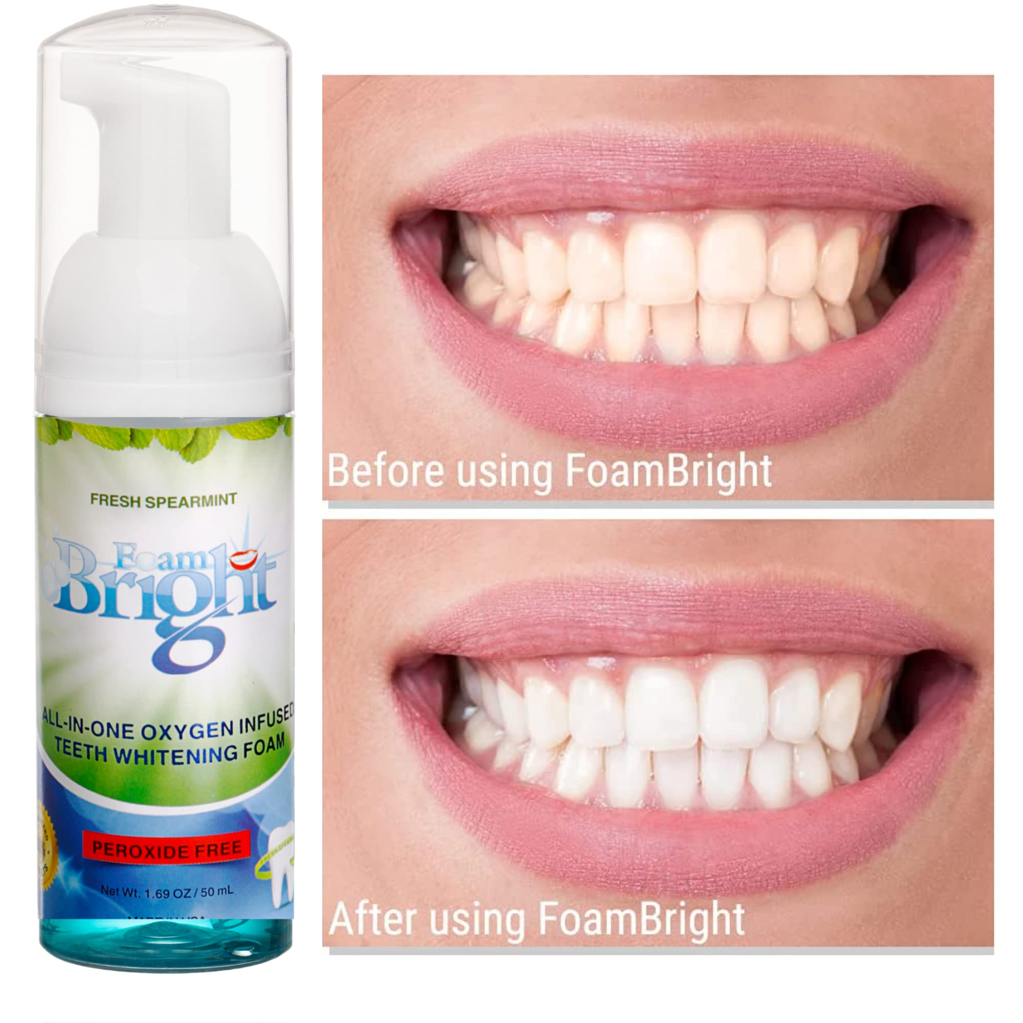**Bright Retainer & Aligner Cleaner Foam – Peroxide-Free Teeth Whitening for Invisalign, Candid, Byte, Dentures & Braces – Gentle Oral Care Alternative to Tablets & Paste – Perfect for Daily Cleaning & Travel**