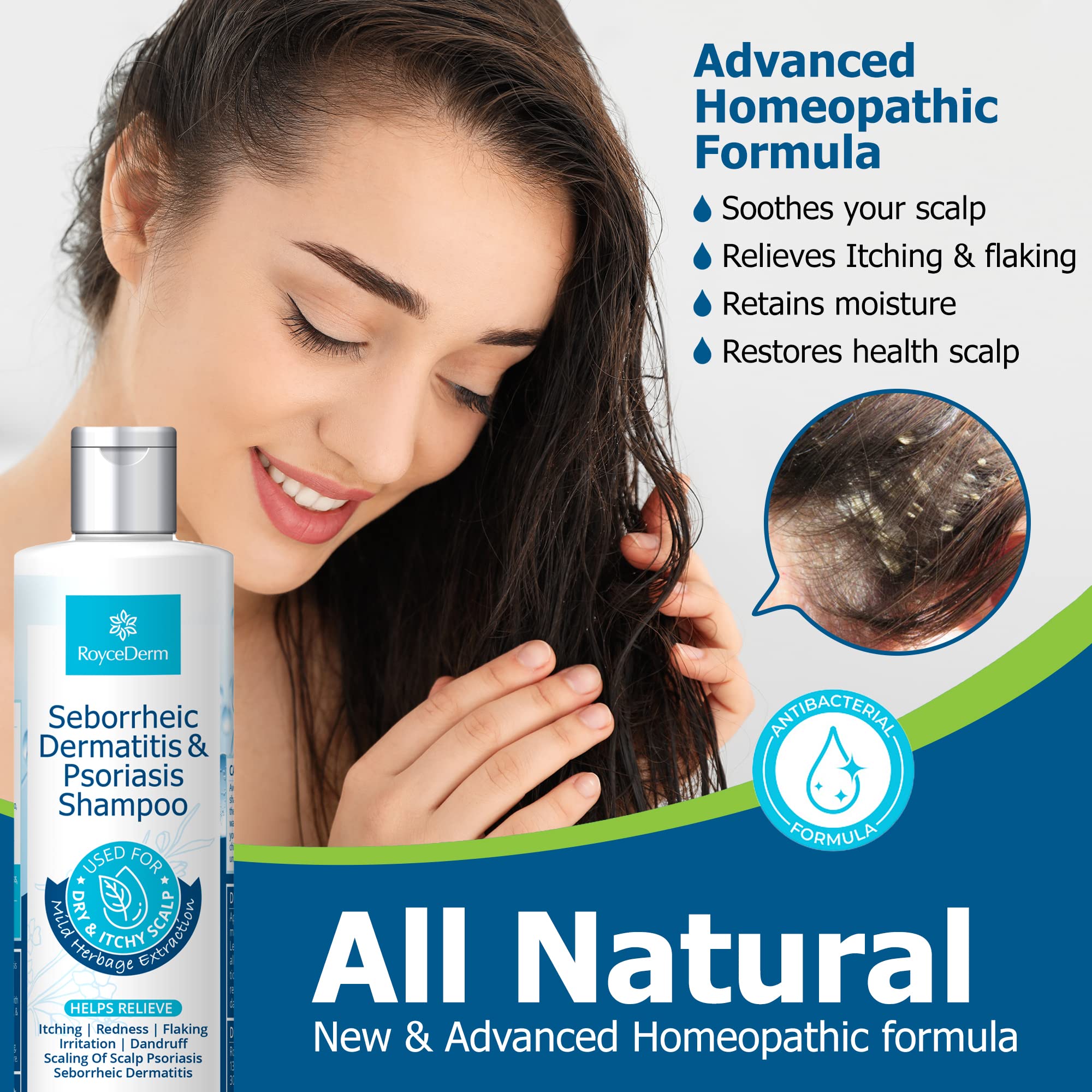 Roycederm Scalp Care Bundle - Psoriasis Shampoo & Conditioner for Dry, Itchy Scalp Relief | Anti-Dandruff Treatment for Men & Women | Perfect for Sensitive Scalp & Flaky Skin Care