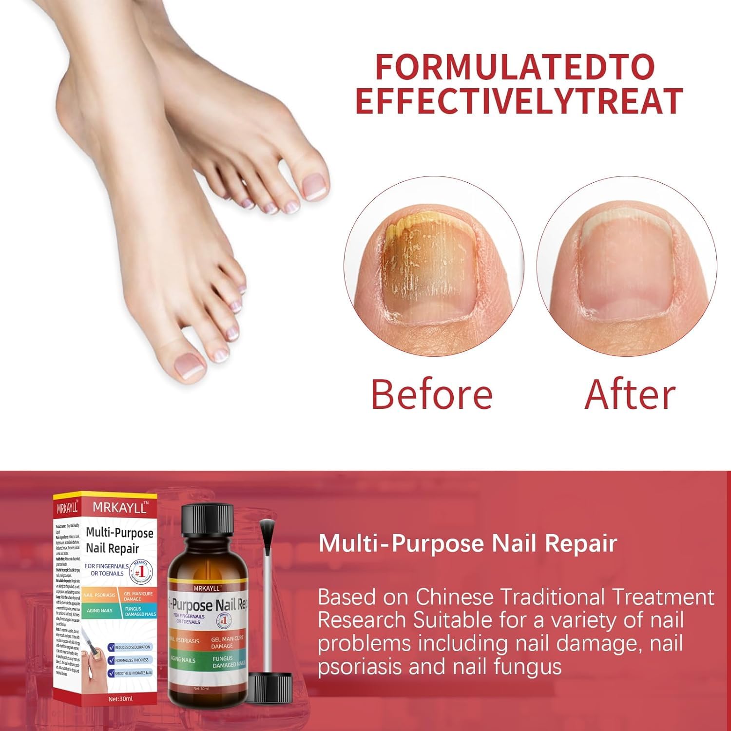 Extra Strength Toenail Fungus Treatment - Fast Acting Antifungal Solution for Toenails & Fingernails | 30ML (1 FLOZ) | Effective Remedy for Athlete's Foot & Nail Discoloration