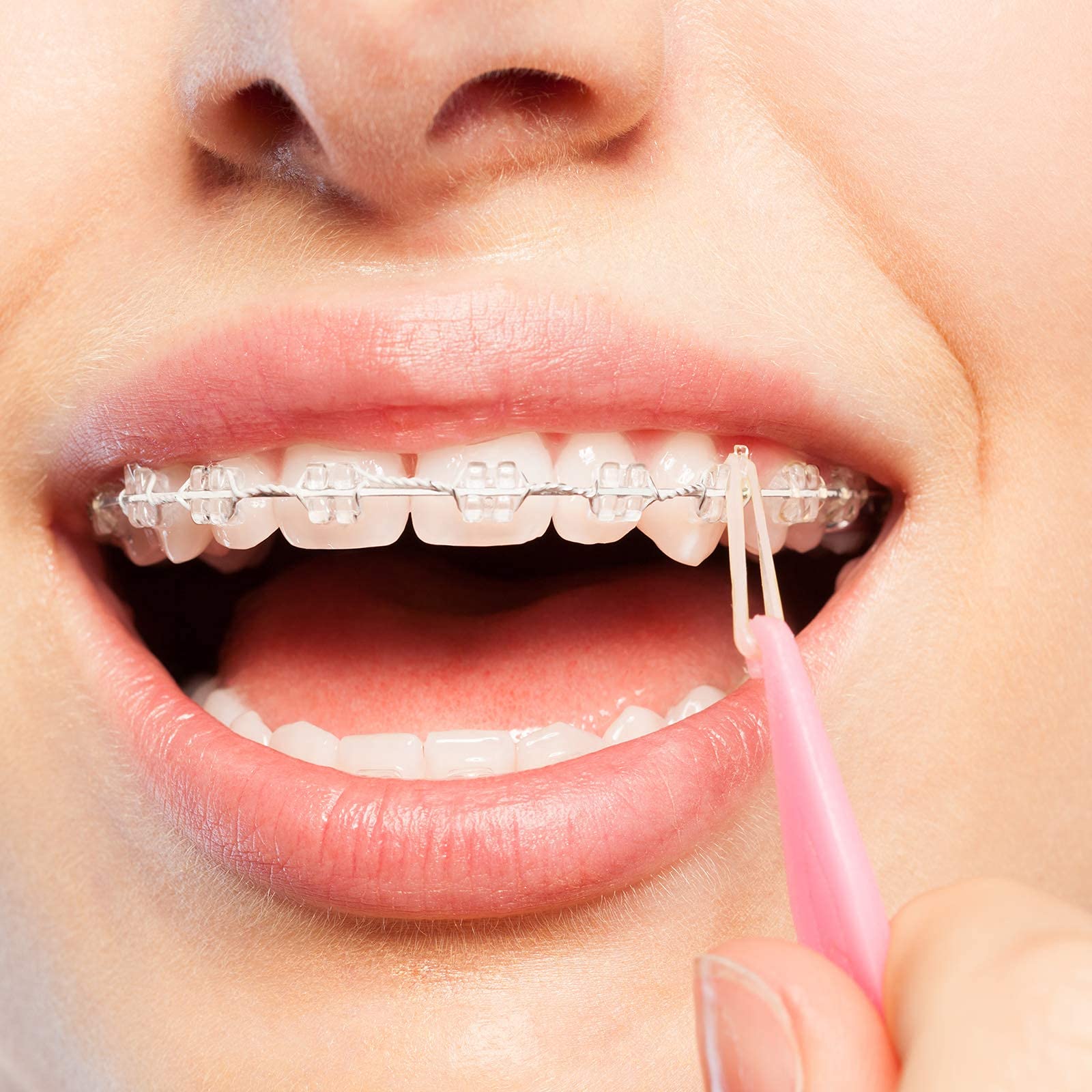 JMU Orthodontic Elastics 1/4