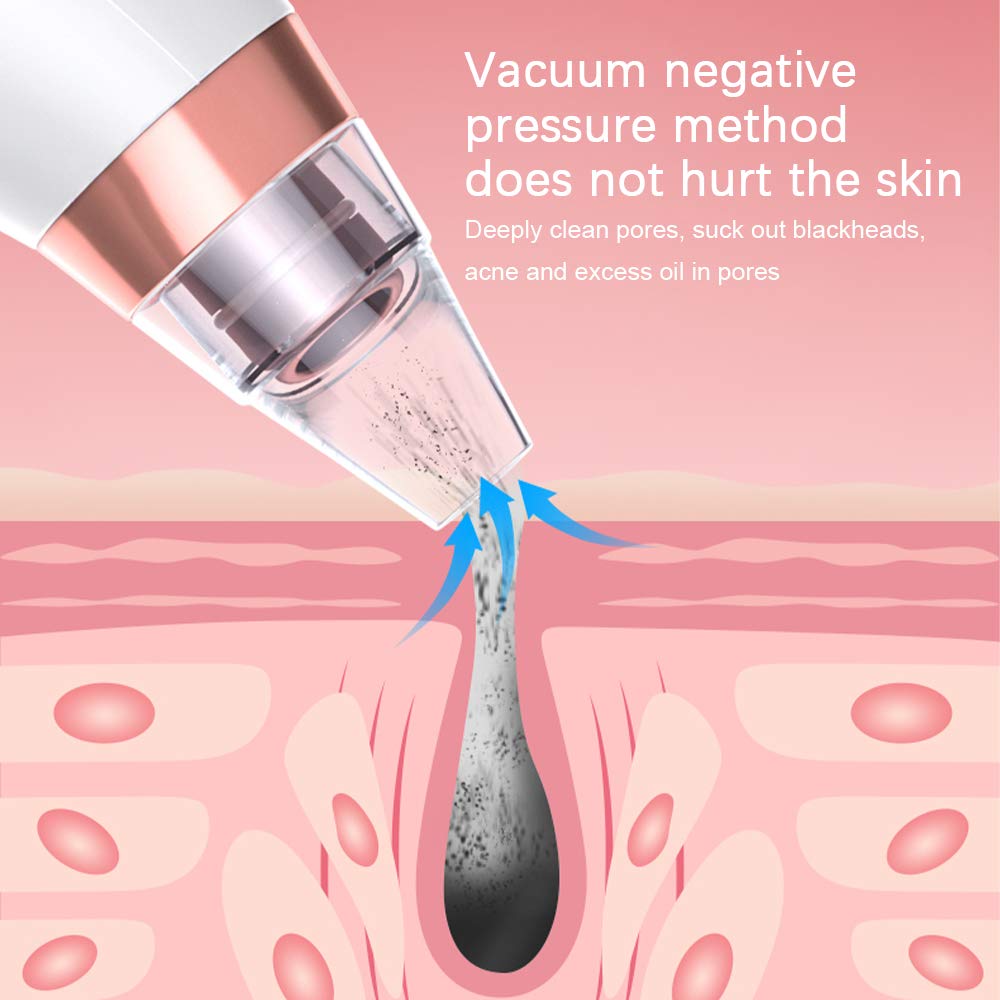Yafei Pore Vacuum Blackhead Remover - Upgraded Strong Suction Rechargeable Facial Cleanser for Blackhead & Pimple Removal (Gray) | Perfect for Deep Cleansing & Skincare Routine