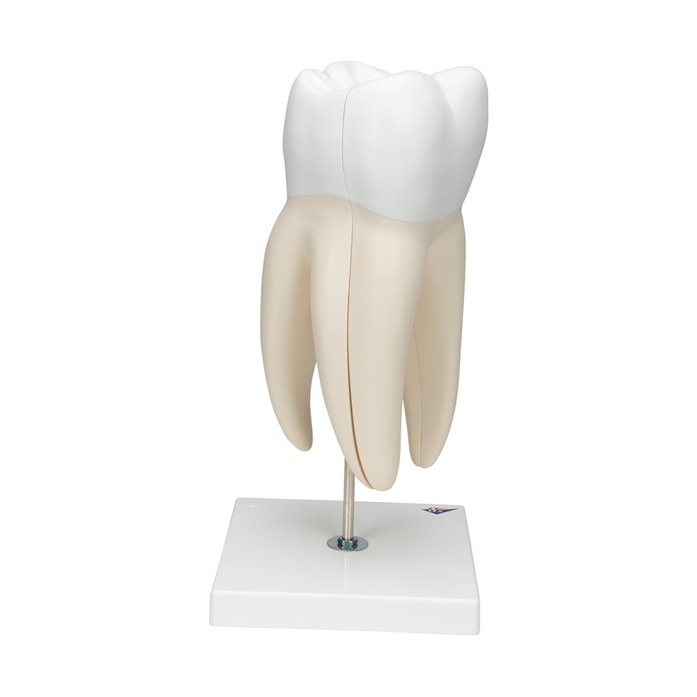 Giant Molar with Cavities - 15x Life Size Dental Model (5-Part) - Perfect for Dental Education, Classroom Demonstrations & Medical Training
