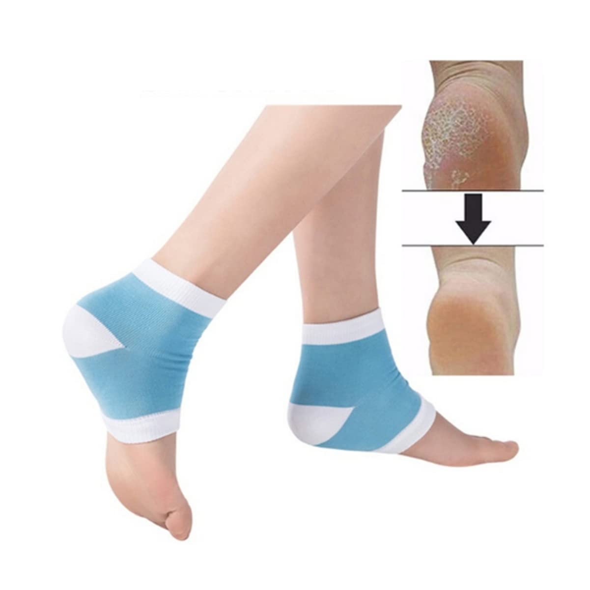 Beaupretty 2 Pairs Whitening Moisturizing Socks for Cracked Heels - Nylon Gel Foot Care Socks with Anti-Chapping Protection - Perfect for Dry Skin & Overnight Foot Treatment