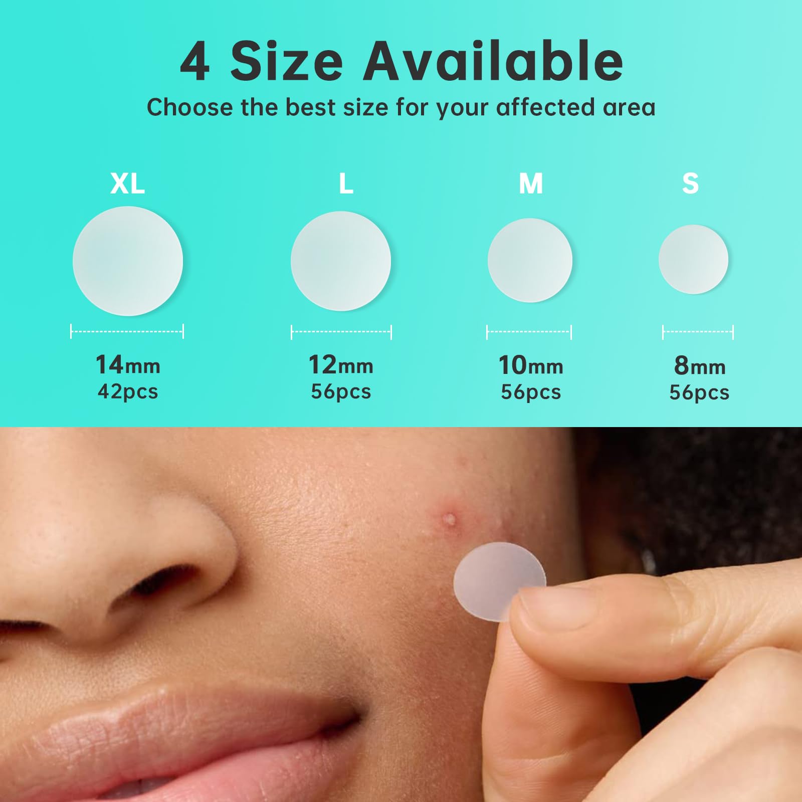 Hydrocolloid Acne Patches for Face - 210 Count Pimple Patches in 4 Sizes, Absorbs Fluid & Treats Zits, Blemishes & Breakouts | Perfect for Overnight Spot Treatment & Daily Acne Care