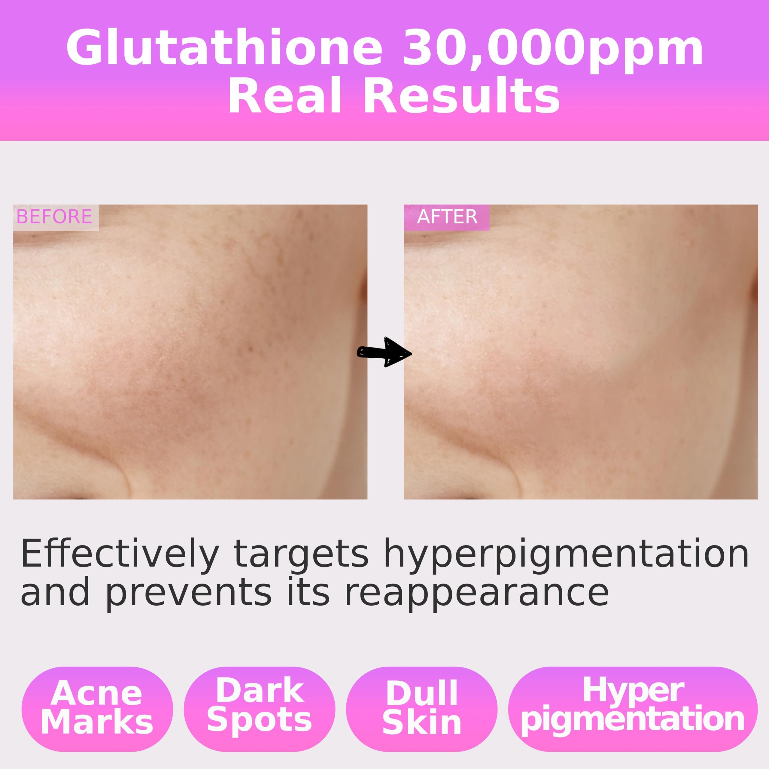 Pure Glutathione Concentrate Serum 30,000ppm with Niacinamide & Hyaluronic Acid - Brightens Skin, Reduces Dark Spots & Acne Scars - Korean Skincare for Sensitive Skin - Perfect for Daily Anti-Aging Routine & Hyperpigmentation Treatment