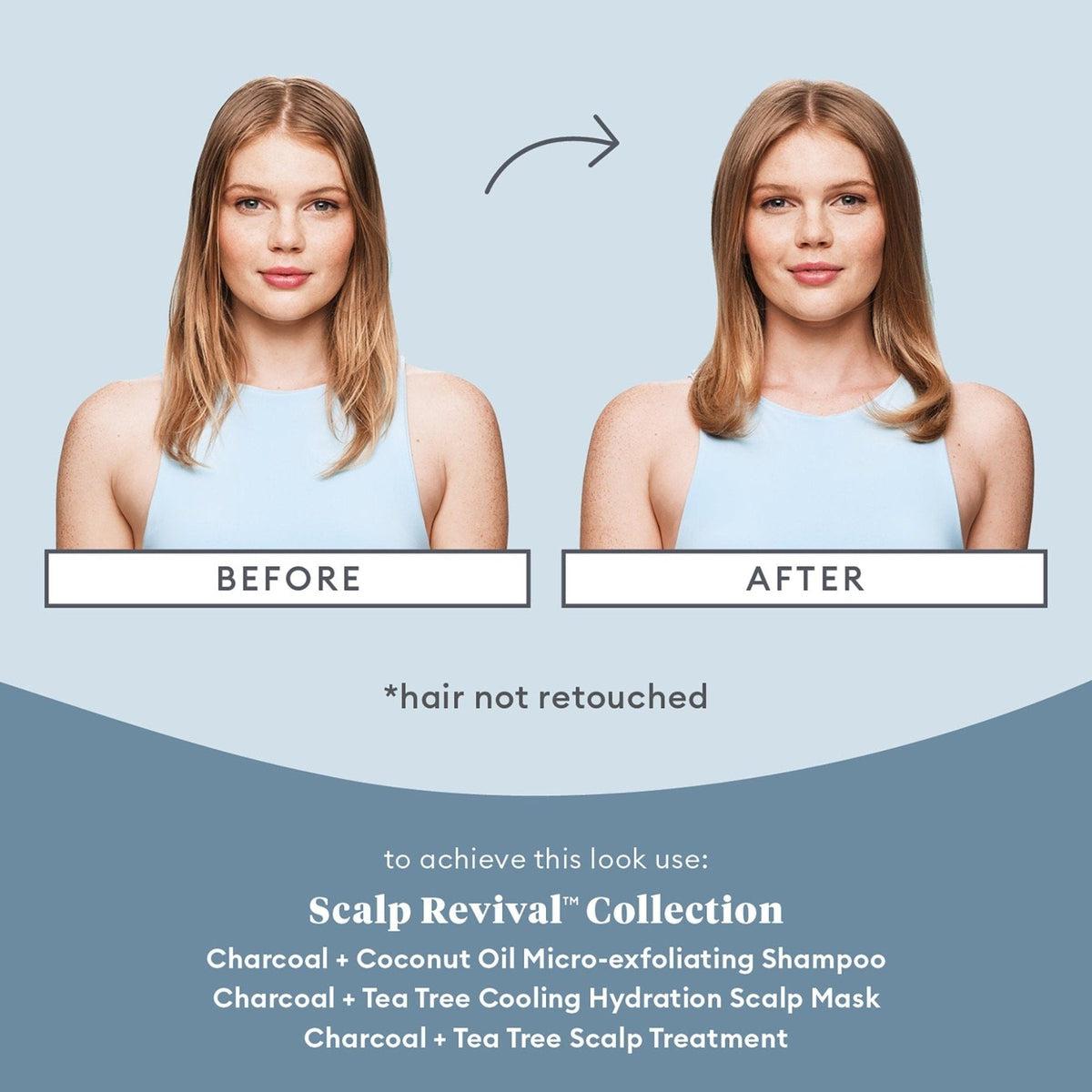 Scalp Revival Charcoal + Tea Tree Cooling Hydration Mask - Detox & Soothe Dry Scalp - Perfect for Dandruff, Itchy Scalp & Hair Growth - Use After Shampoo for Deep Hydration