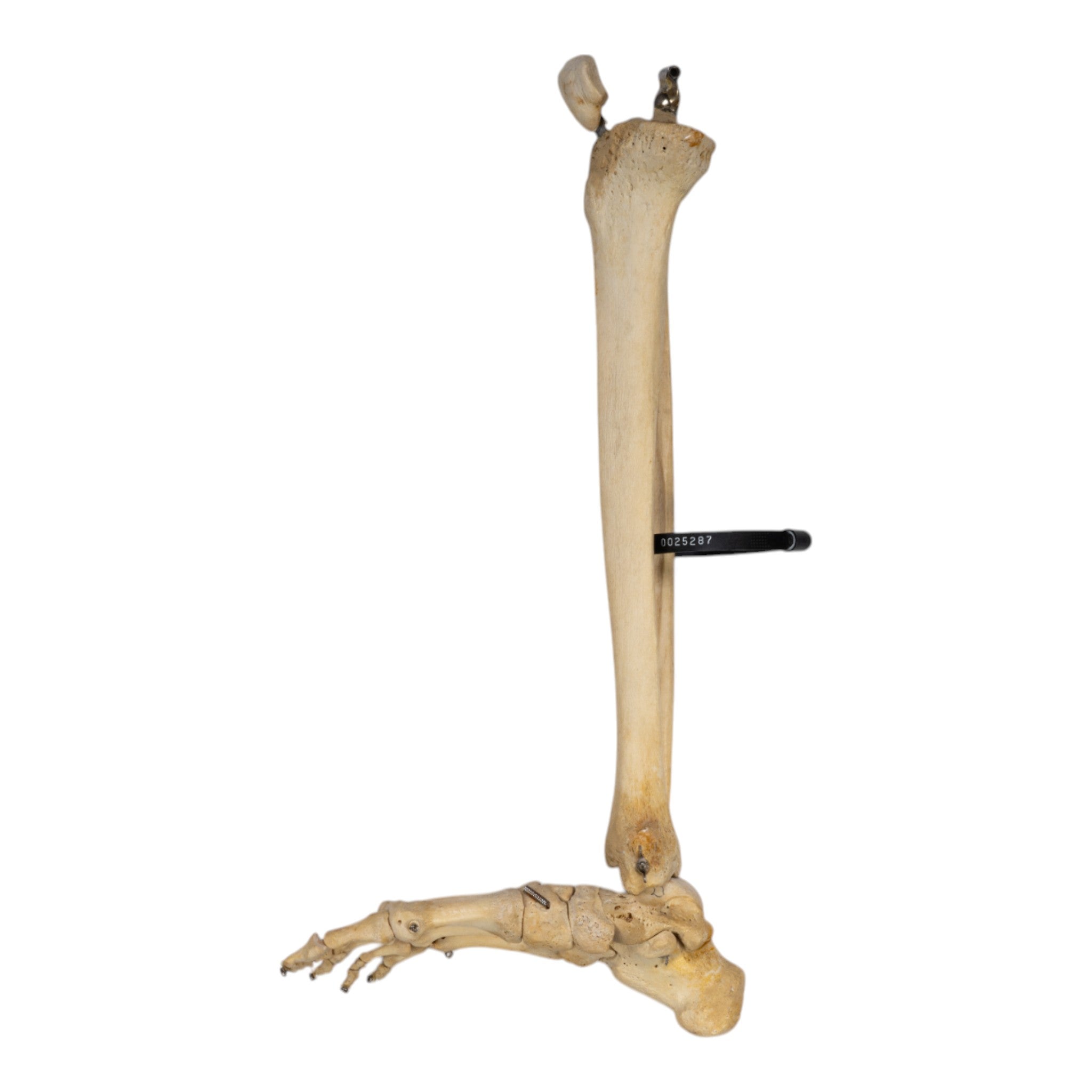 Realistic Human Right Leg Prosthetic - Partial & Articulated for Medical Training, Amputee Rehabilitation & Anatomy Study