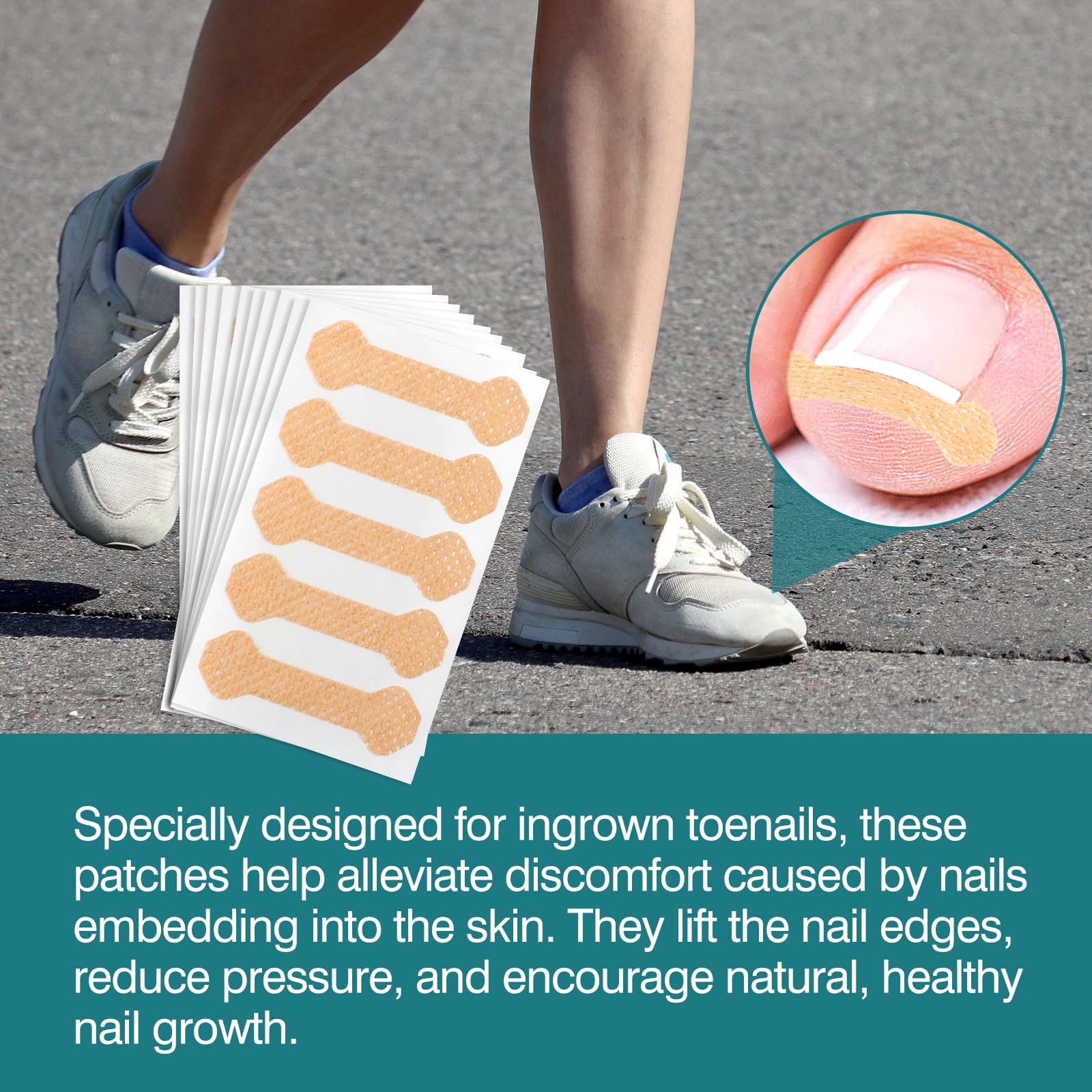**Professional Ingrown Toenail Treatment Strips – 100 Pcs Pedicure Kit for Pain Relief & Toenail Correction – Ideal for Home Care & Salon Use**
